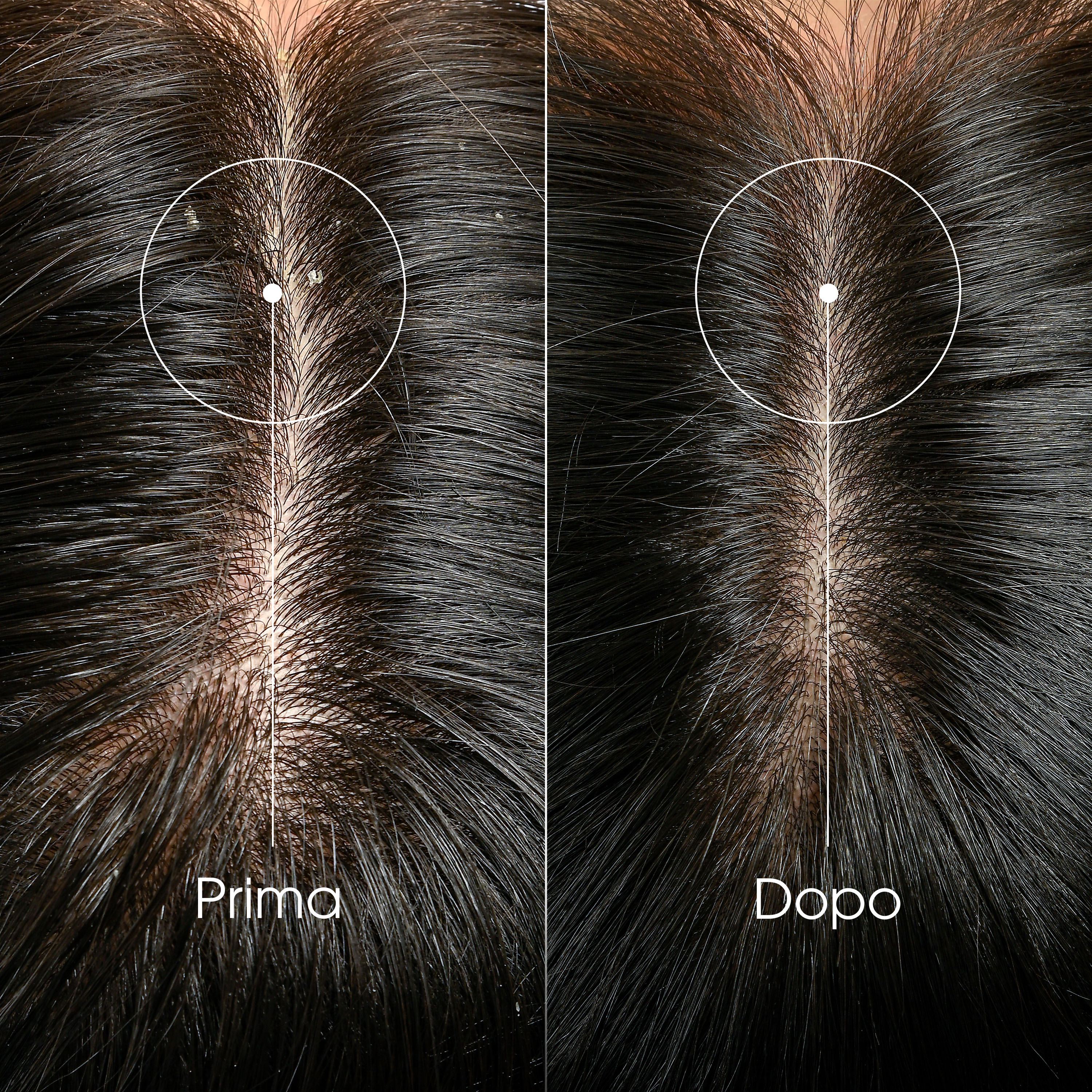 Klorane Anti-Forfora Shampoo trattante e riequilibrante alla Galanga, forfora secca e grassa, 200 ml