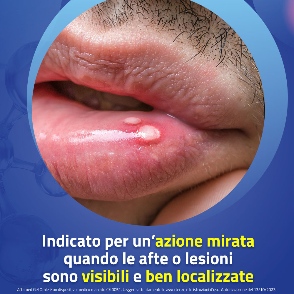 AFTAMED Gel Orale 10ml AFTAMED Gel Orale 10ml