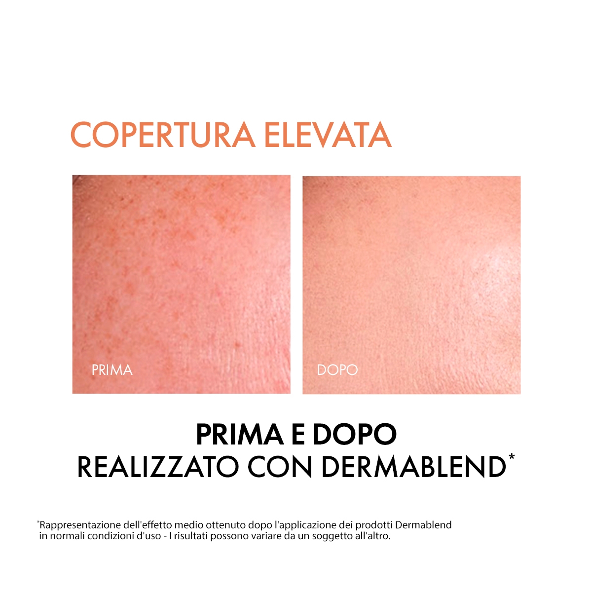 Vichy Dermablend Fondotinta Correttore Fluido 16h tonalità 55 30 ml Vichy Dermablend Fondotinta Correttore Fluido 16h tonalità 55 30 ml