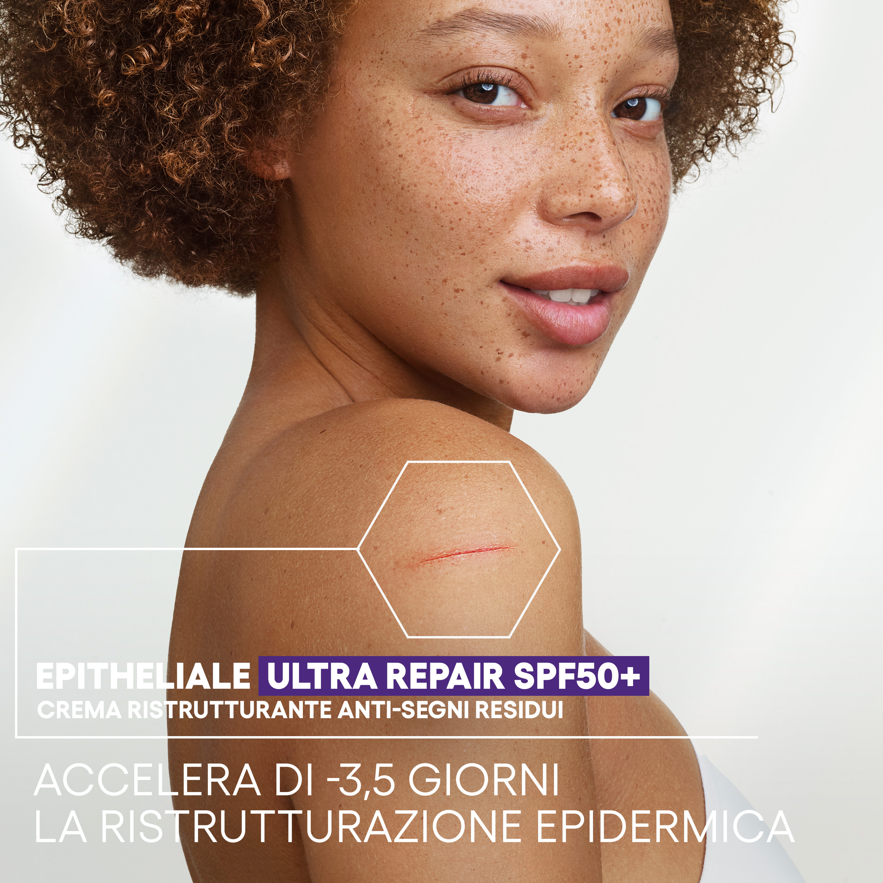 A-Derma Epitheliale Ultra Repair SPF50+ Crema ristrutturante anti-segni residui, riparazione cutanea, protezione solare molto alta,  40 ml