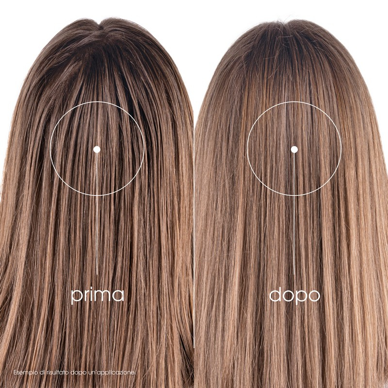KLORANE SHAMPOO SECCO ORT150ML KLORANE SHAMPOO SECCO ORT150ML