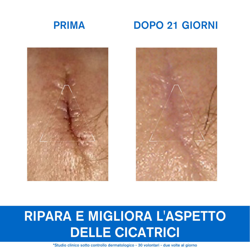 URIAGE BARIÉDERM-CICA Crema dermatologica multiuso per la riparazione della pelle 100 ml