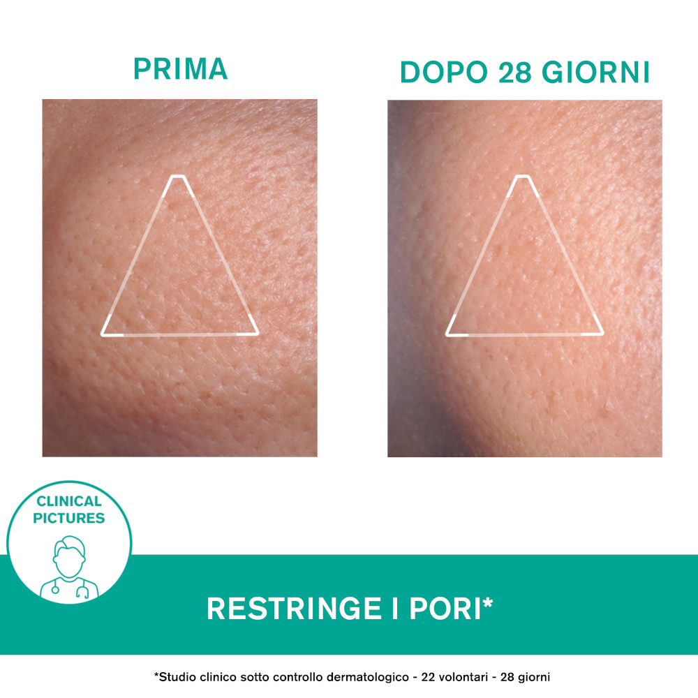 Uriage Hyséac Mat Trattamento Opacizzante Viso 40 ml Uriage Hyséac Mat Trattamento Opacizzante Viso 40 ml