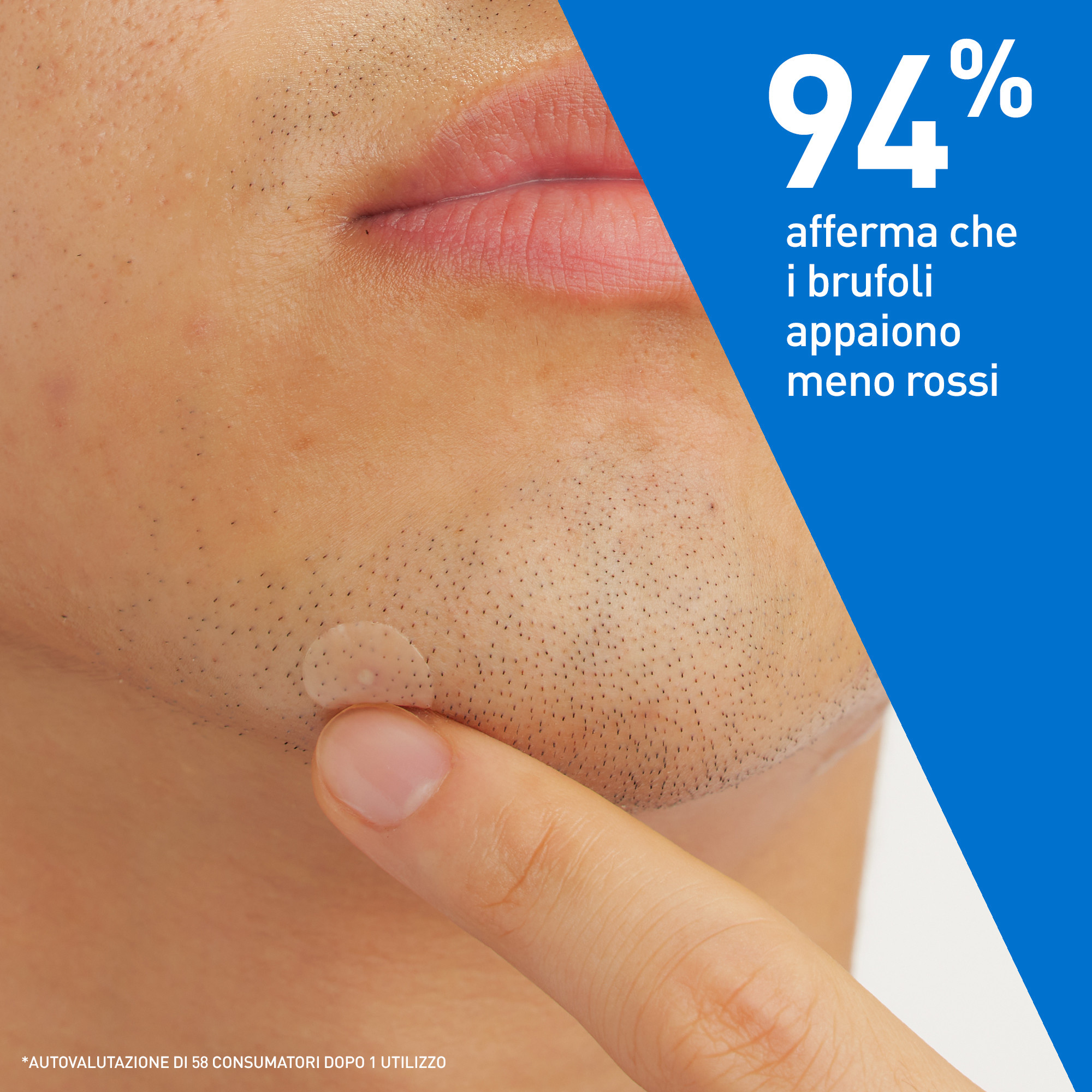 CeraVe Patches Idrocolloidali Anti Brufoli, Per Pelli a Tendenza Acneica, Trasparenti e Invisibili sulla Pelle, Non lascia segni, Con Niacinamide e 3 Ceramidi Essenziali, 22 Pezzi