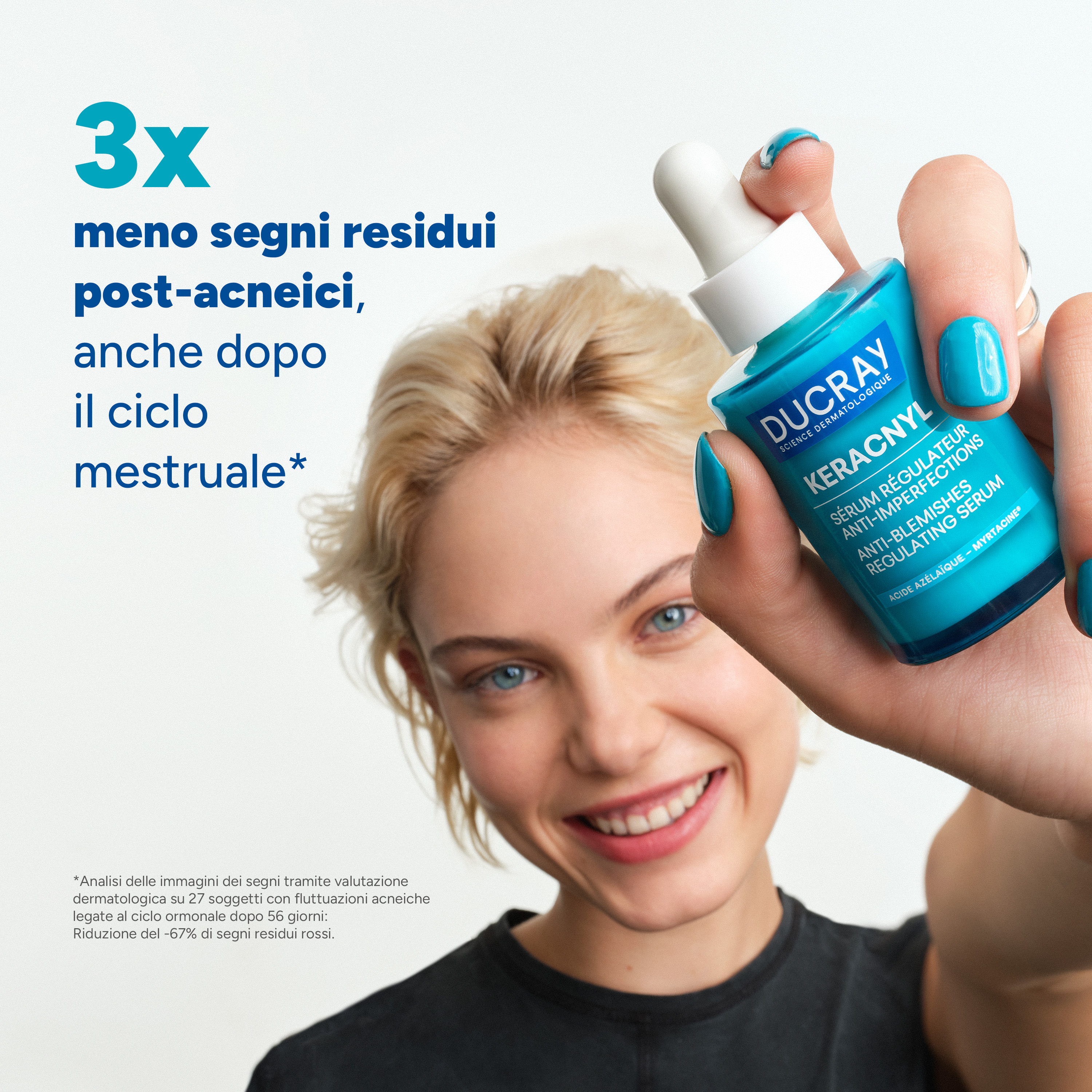 Ducray Keracnyl - Siero Regolatore Anti-Imperfezioni Per Pelle Acneica 30 ml