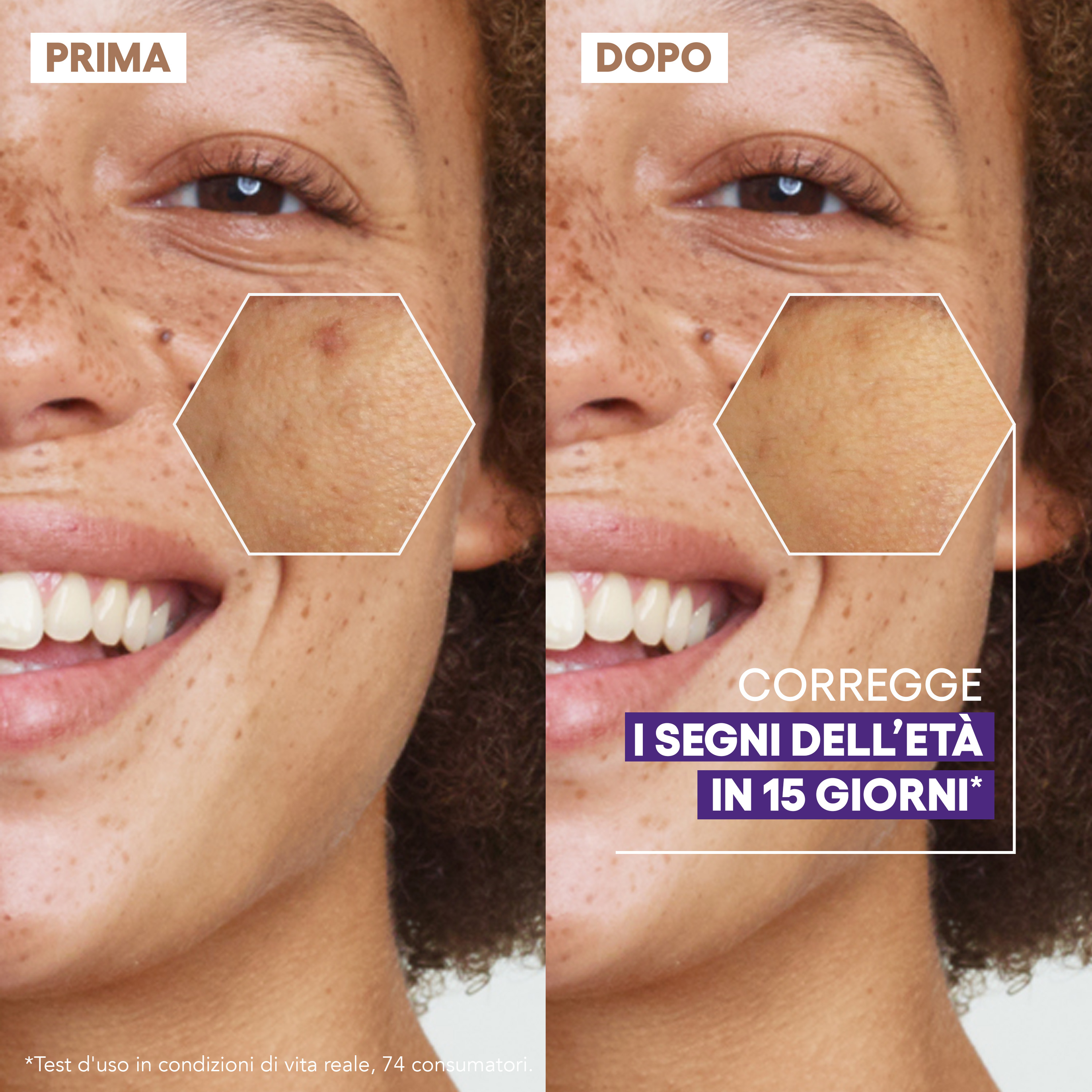 A-Derma Epitheliale Ultra Repair Siero ristrutturante luminosità, Anti-macchie, Vitamina C, 30ml 