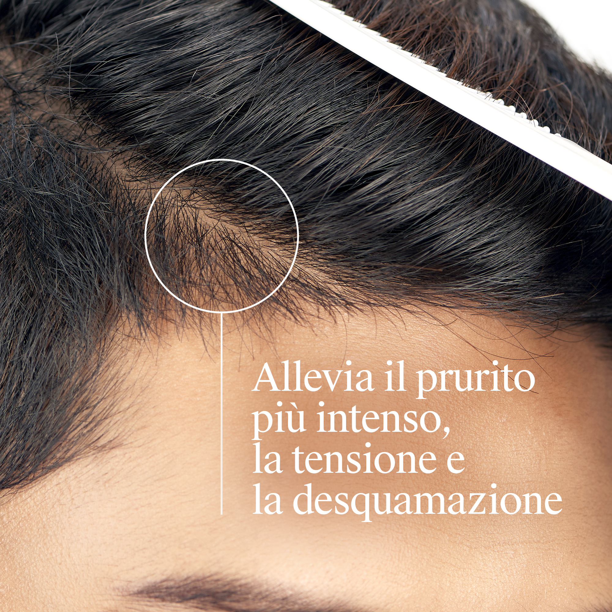 Neutrogena T/Gel - Shampoo Antiforfora Forte Per Adulti 150 ml