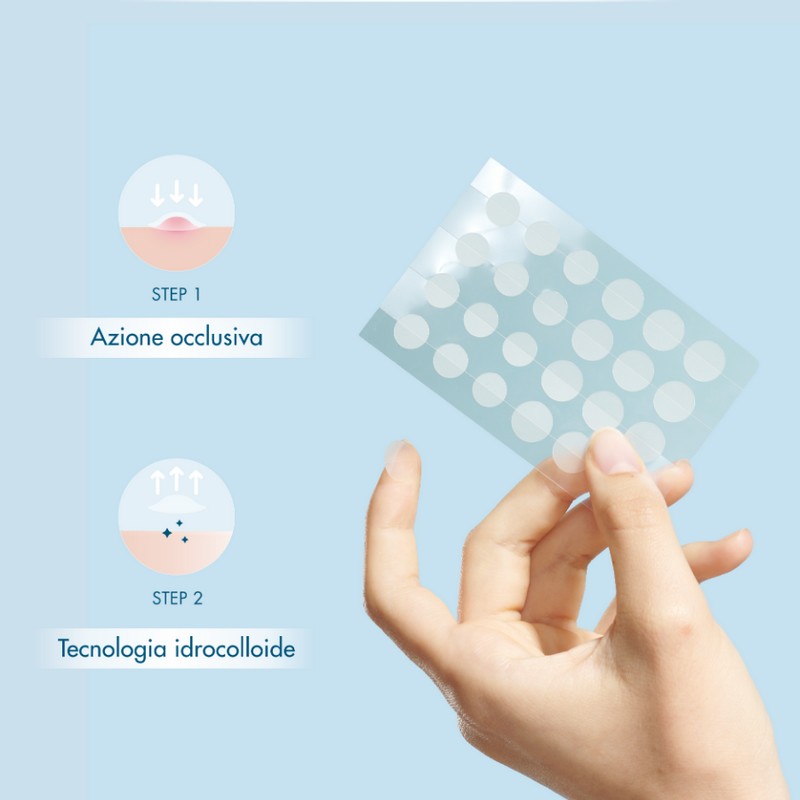 Miamo Acnever - 48 Patches Anti-Imperfezioni Per Pelle Grassa E Acneica