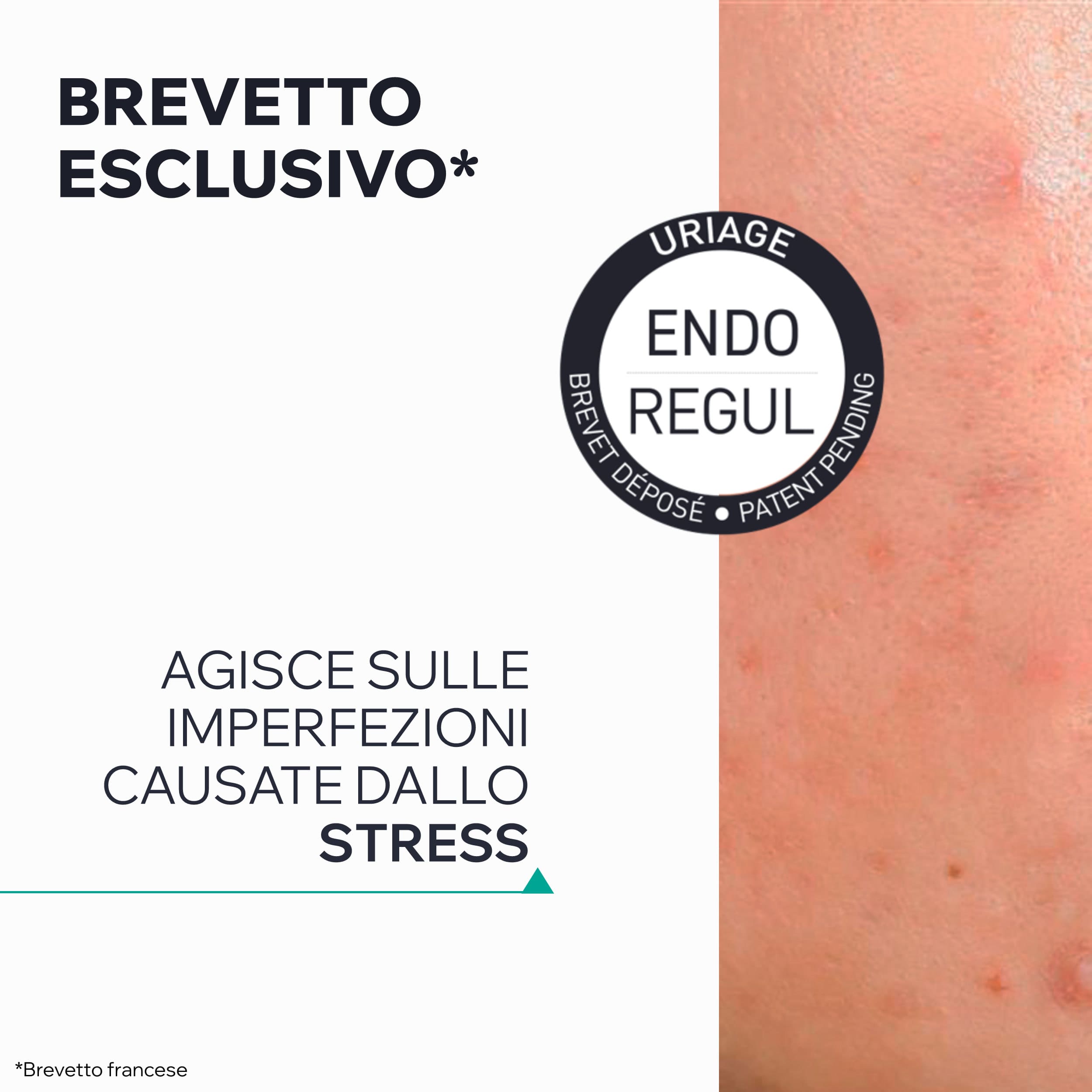 Uriage - Hyséac - Siero Pelle Nuova Booster Anti-Imperfezioni 30 ml