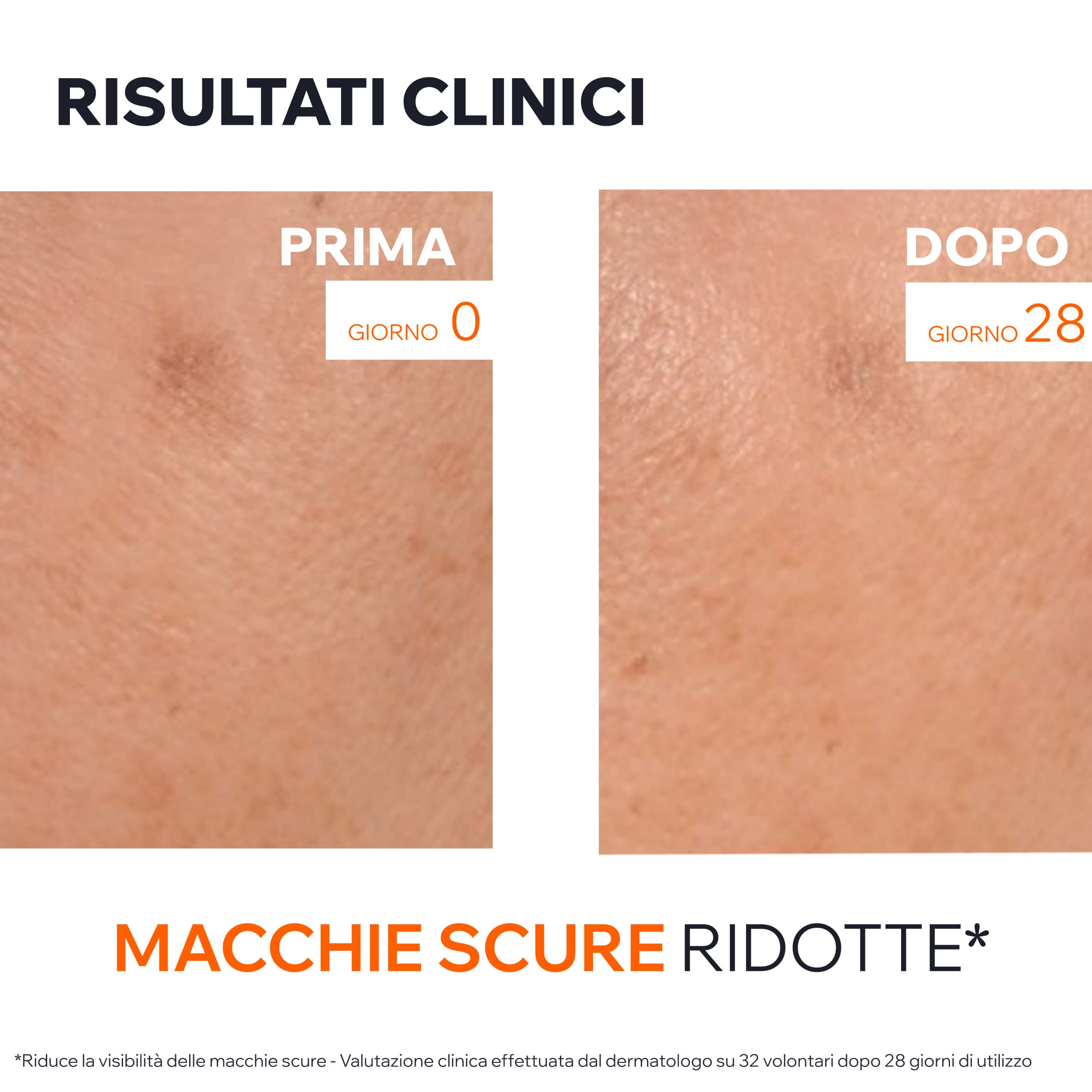 Uriage - Dépiderm - Siero Anti-Macchie Booster Illuminante 30 ml