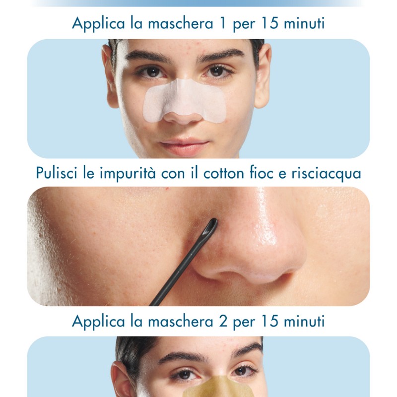 Miamo Acnever - Blackhead Clear Duo Nose Mask - 5 Maschere Anti-Acne