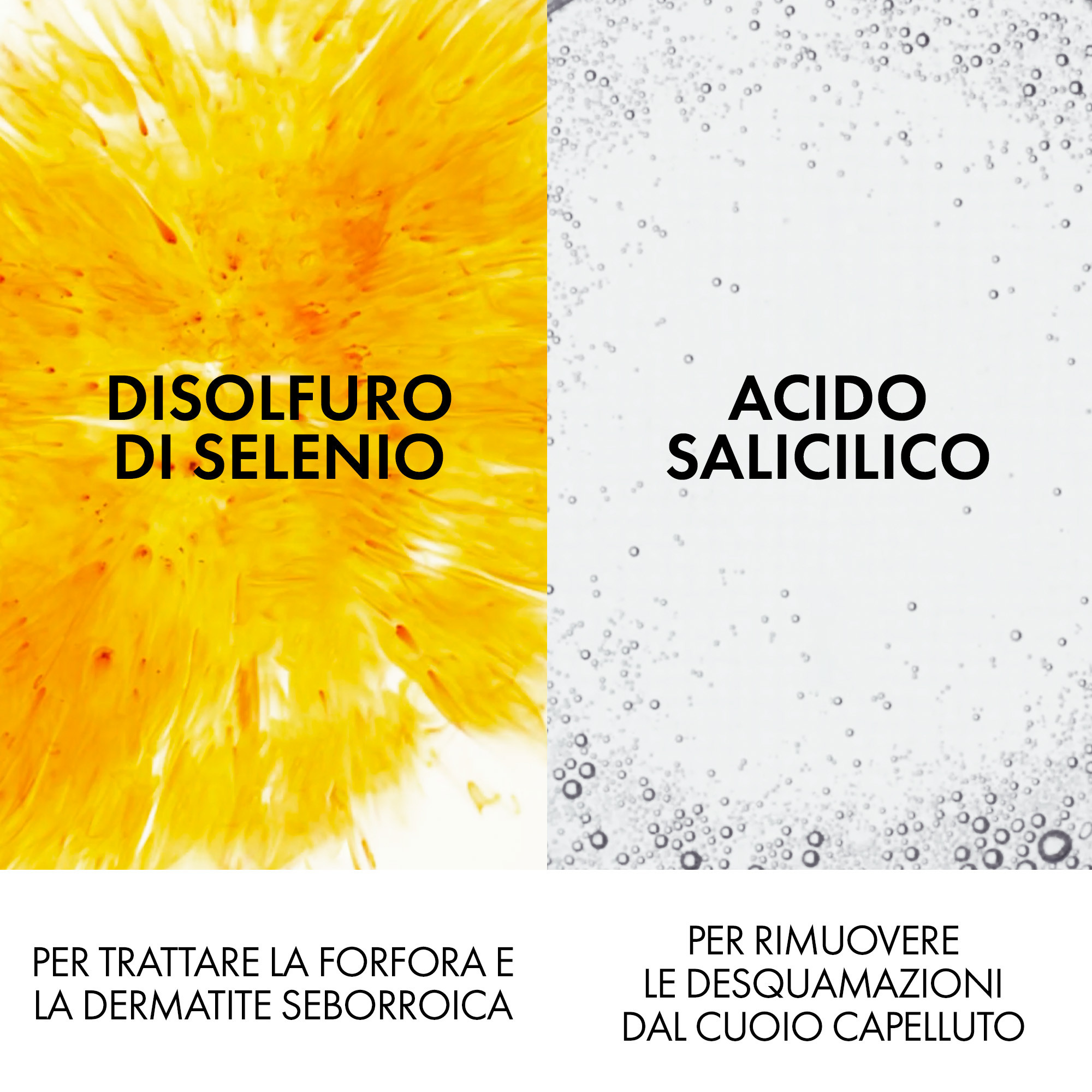 Vichy Dercos Technique Shampoo Antiforfora Ds Grassi per Forfora e Prurito 390ml