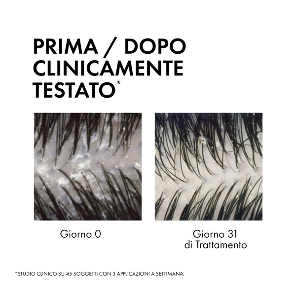 Vichy Dercos Trattamento Antiforfora 2in1 Shampoo+Balsamo  200ml