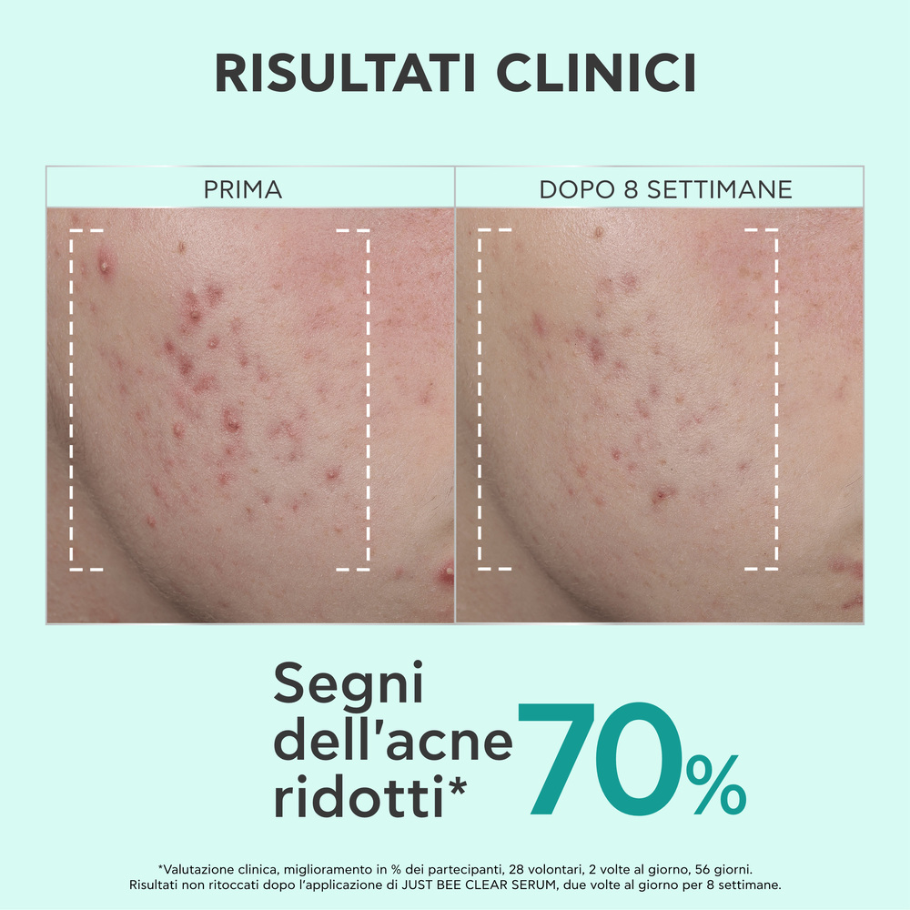 Apivita Just Bee Clear - Siero Perfezionatore, Affinante E Anti-Macchie 30 ml