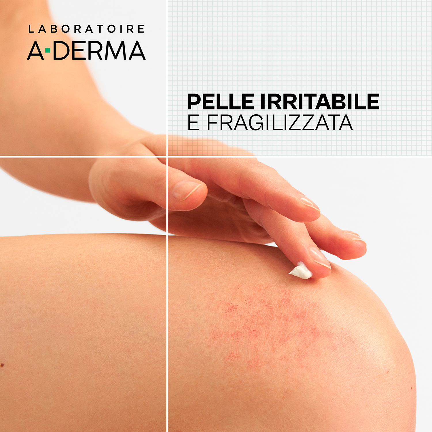 A-Derma Dermalibour+ - Cica Crema Ristrutturante Purificante Per Pelle Irritata E Fragile 50 ml 