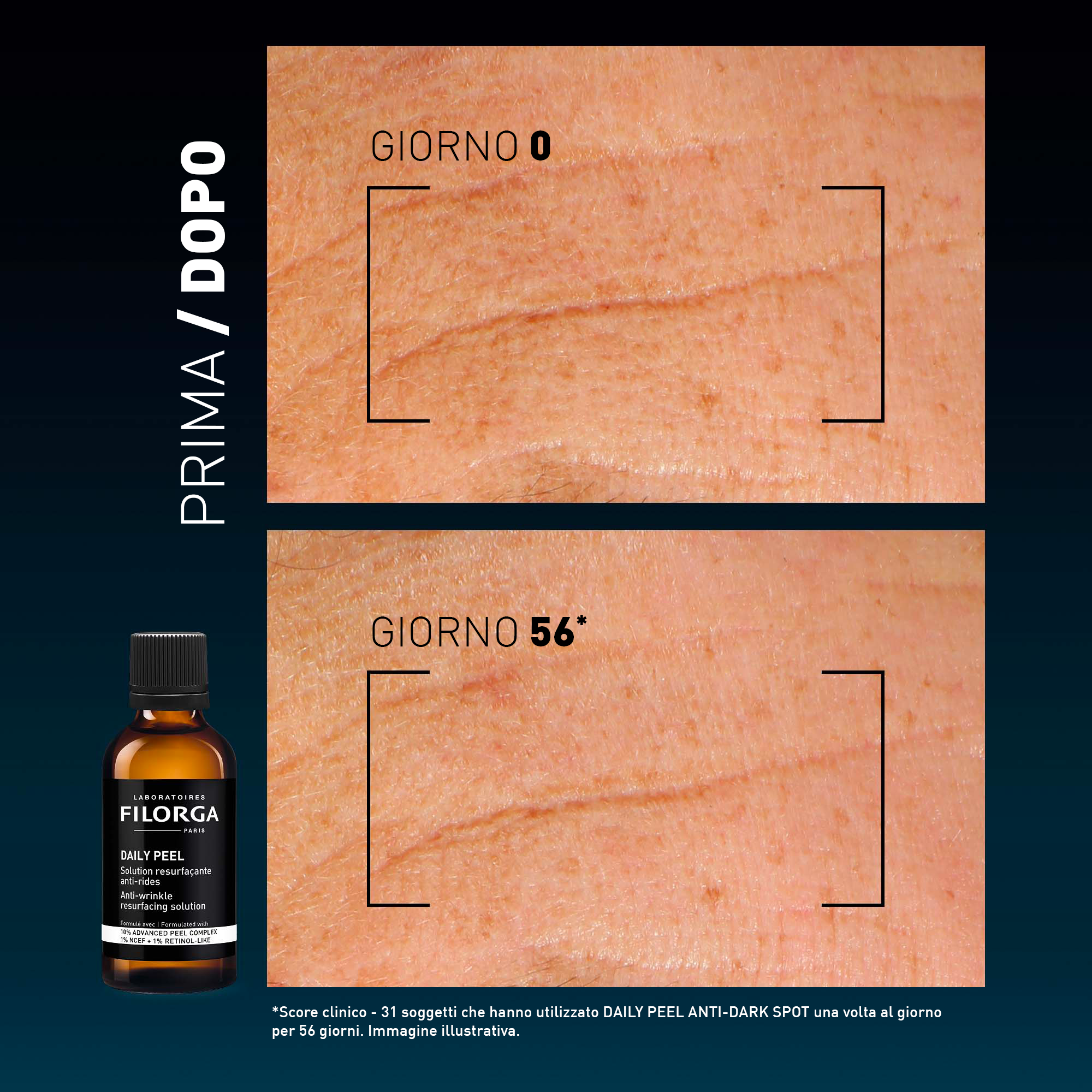 FILORGA DAILY PEEL WRINK 50ML