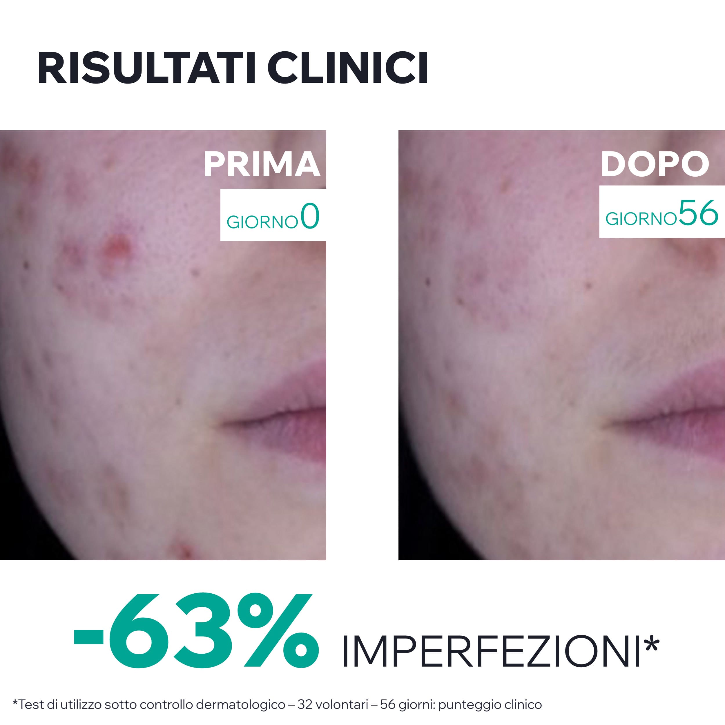 Uriage - Hyséac 3-Regul+ - Trattamento Globale Anti-Imperfezioni Viso 40 ml