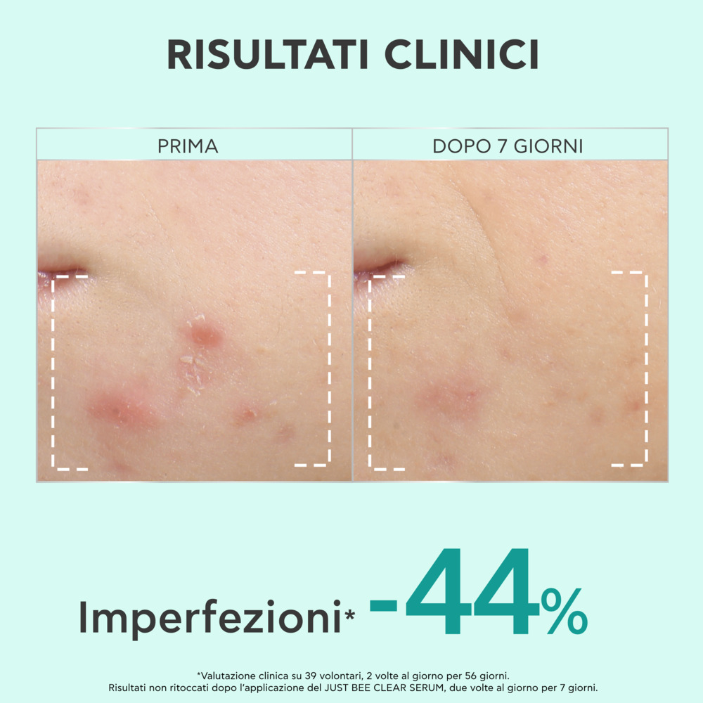 Apivita Just Bee Clear - Siero Perfezionatore, Affinante E Anti-Macchie 30 ml