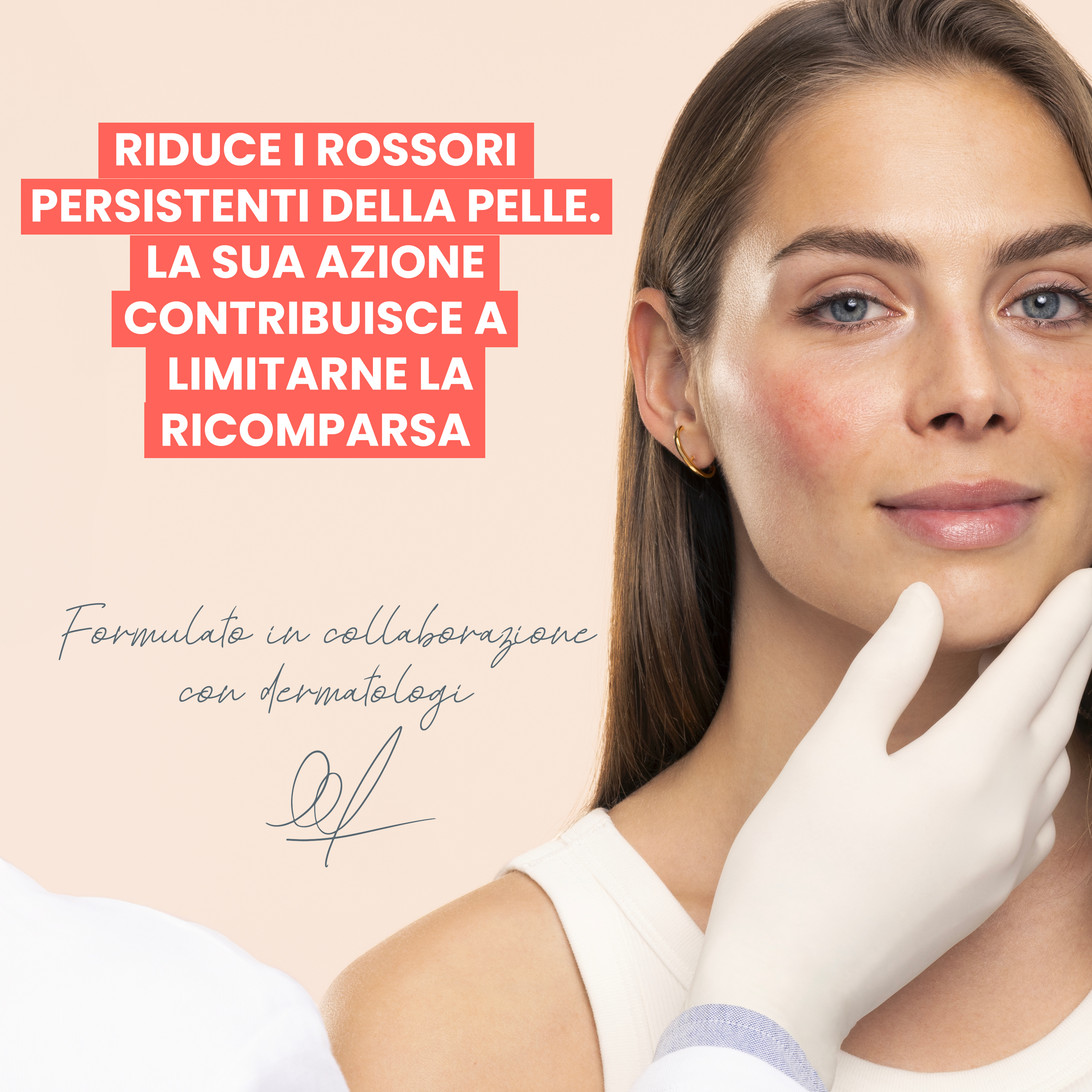 Avène Antirougeurs Rosamed - Concentrato Rossori Persistenti Per Pelle Arrossata 30 ml