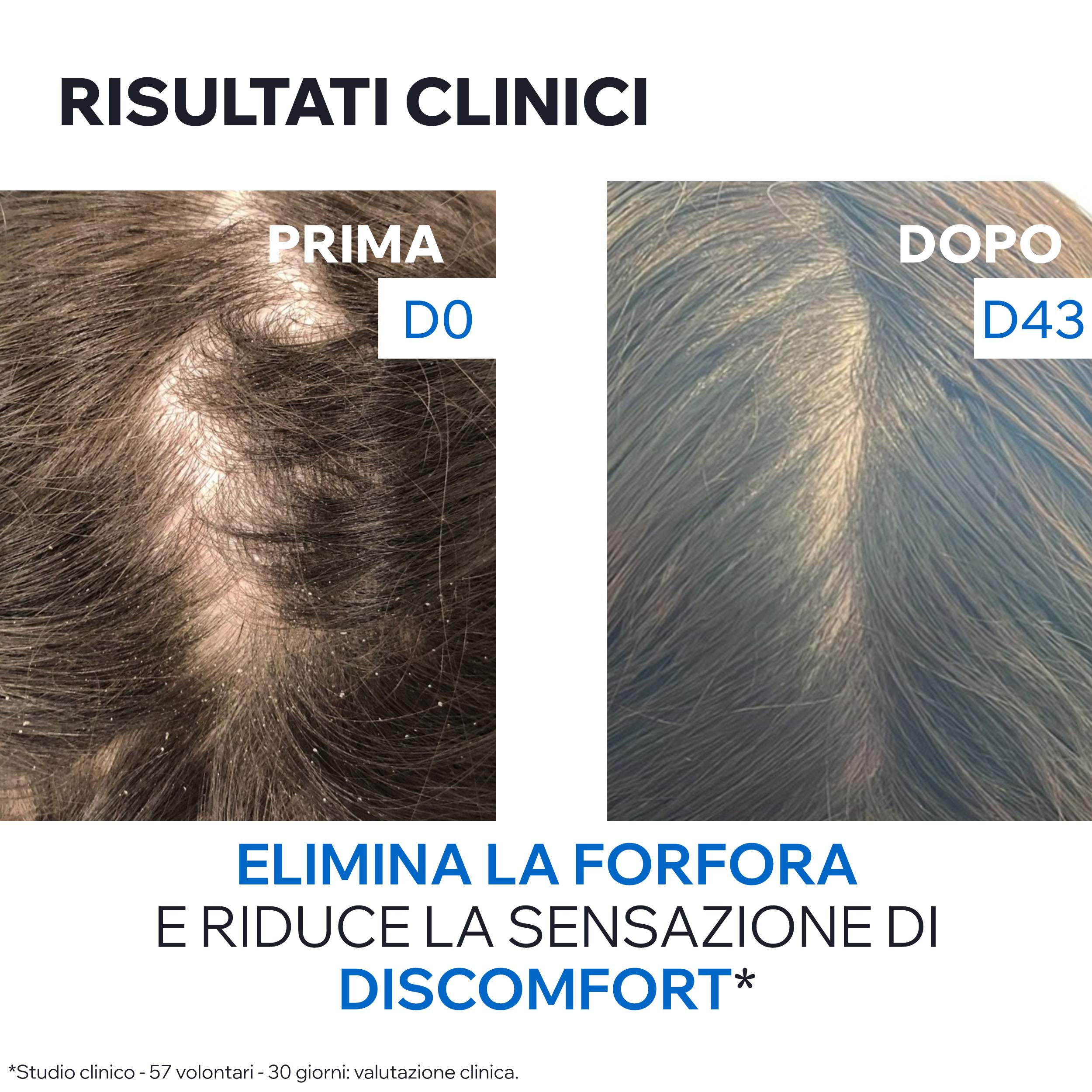 Uriage DS Hair - Shampoo Antiforfora Per Forfora Moderata, Secca O Grassa 500 ml