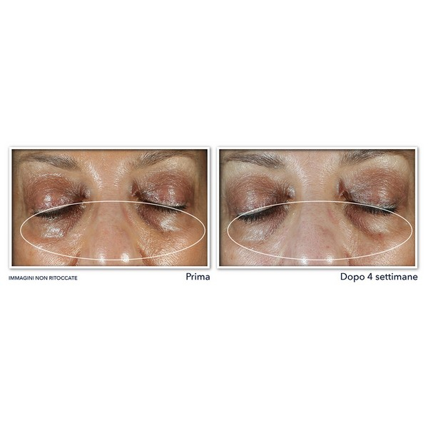 RoC Multi Correxion® Even Tone + Lift Crema Contorno Occhi 15ml