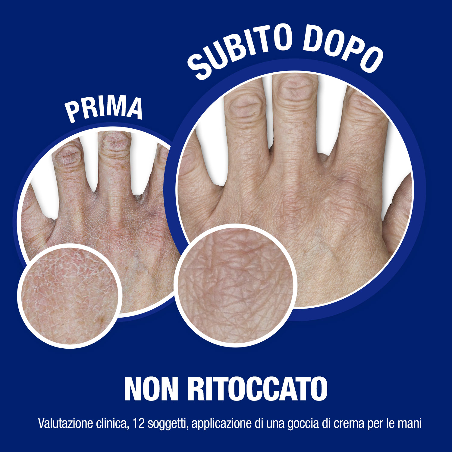 Neutrogena Crema Mani e Unghie Idratante Rafforzante 75 ml Neutrogena Crema Mani e Unghie Idratante Rafforzante 75 ml