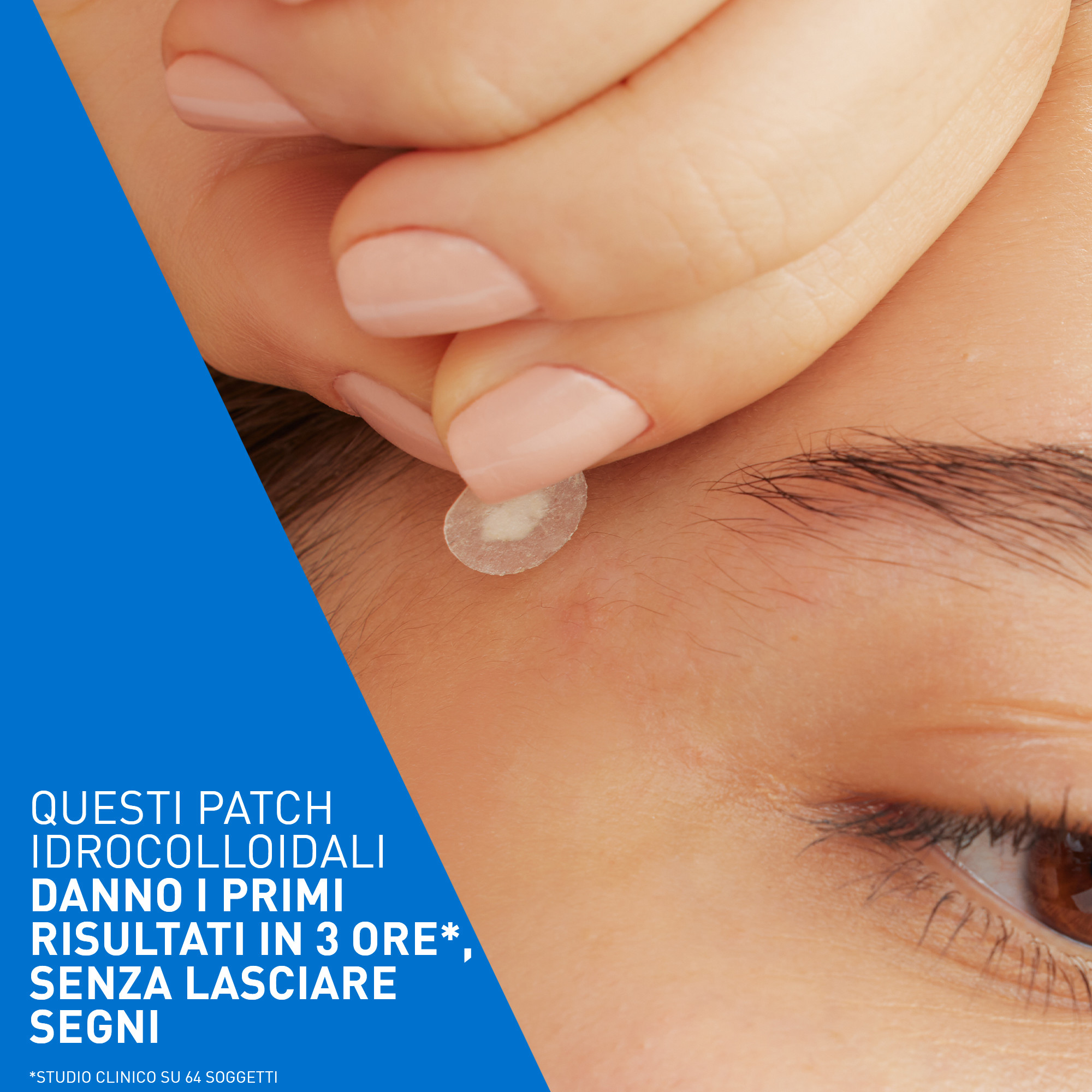 CeraVe Patches Idrocolloidali Anti Brufoli, Per Pelli a Tendenza Acneica, Trasparenti e Invisibili sulla Pelle, Non lascia segni, Con Niacinamide e 3 Ceramidi Essenziali, 22 Pezzi