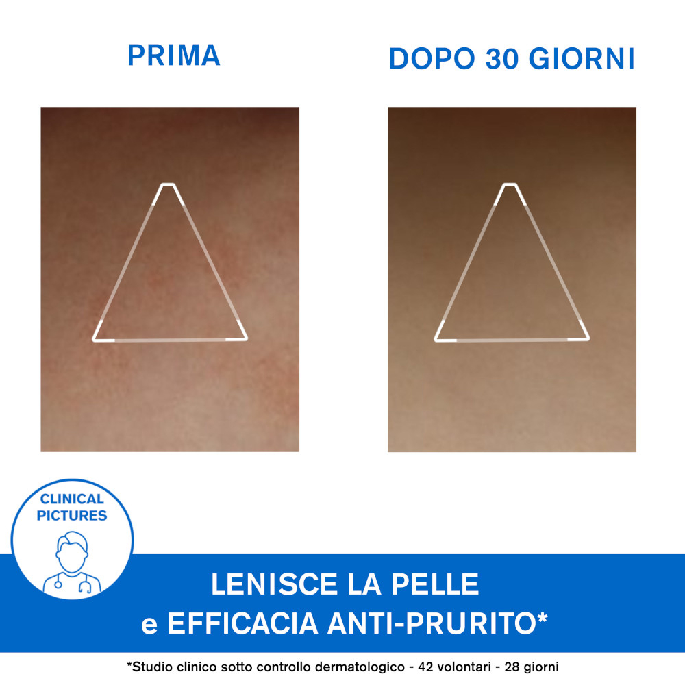 Uriage Xémose Cerato Liporestitutivo Anti-irritazioni 200 ml