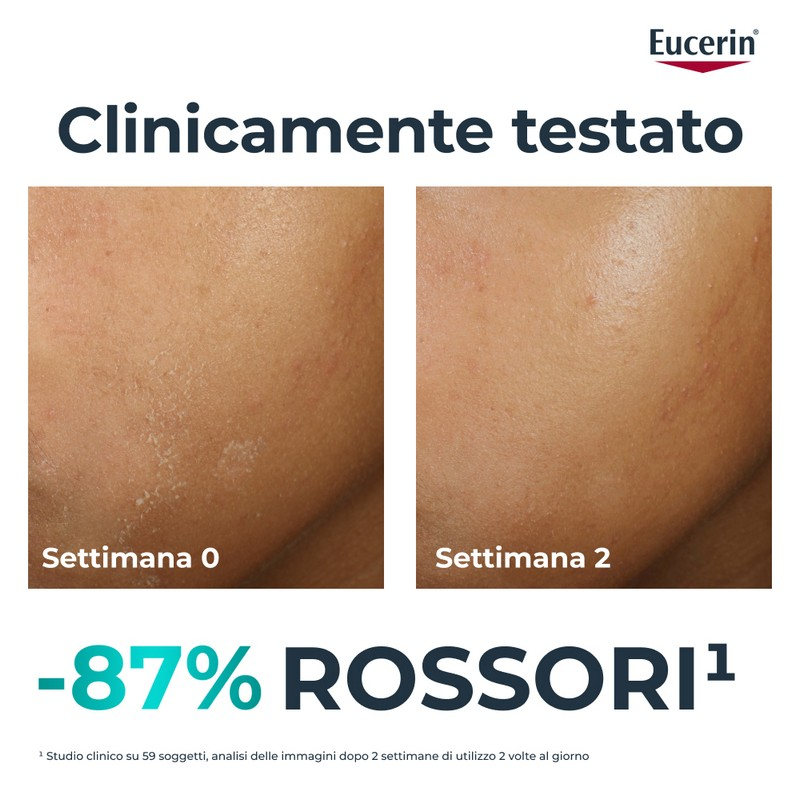 EUCERIN DC TRATTAMENTO LENIT