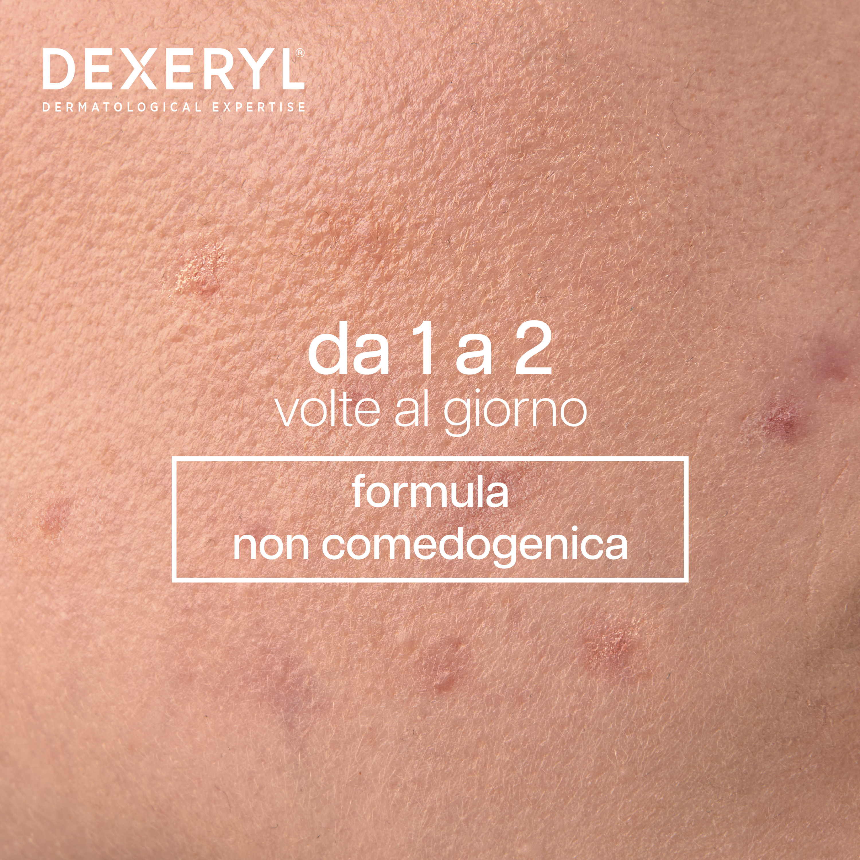 Dexeryl Dexeclear - Detergente Idratante Lenitivo Per Pelle Grassa E A Tendenza Acneica 200 ml