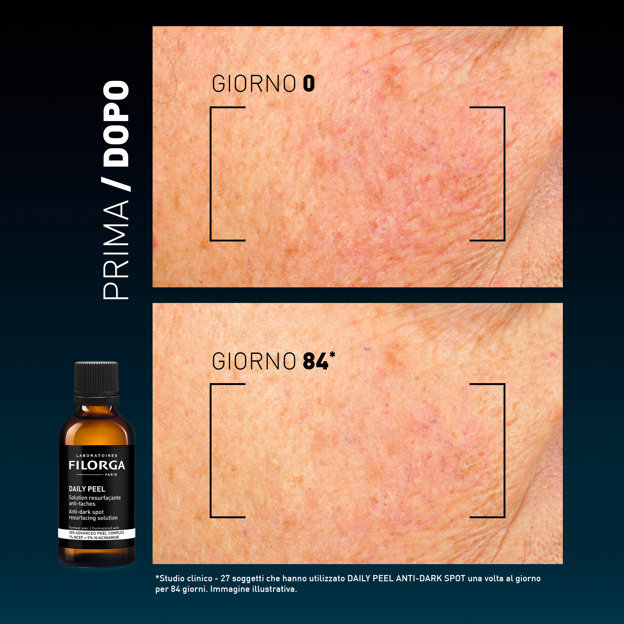FILORGA DAILY PEEL DARK 50ML