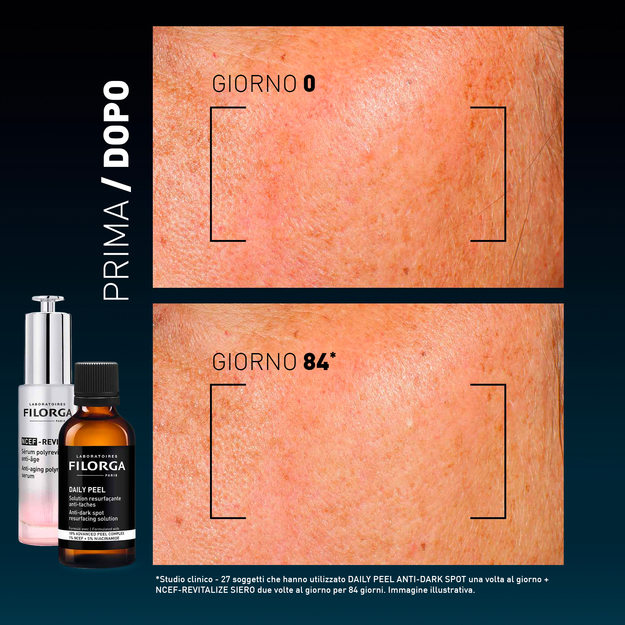FILORGA DAILY PEEL DARK 50ML