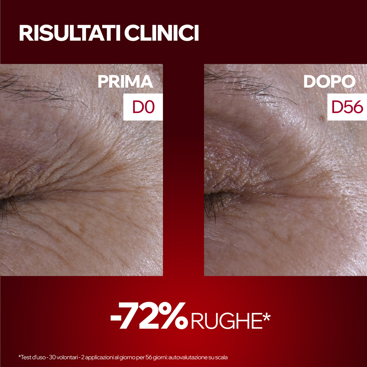Uriage Age Lift R3 - Crema Giorno Antirughe Effetto Tensore Per Pelle Sensibile 40 ml 