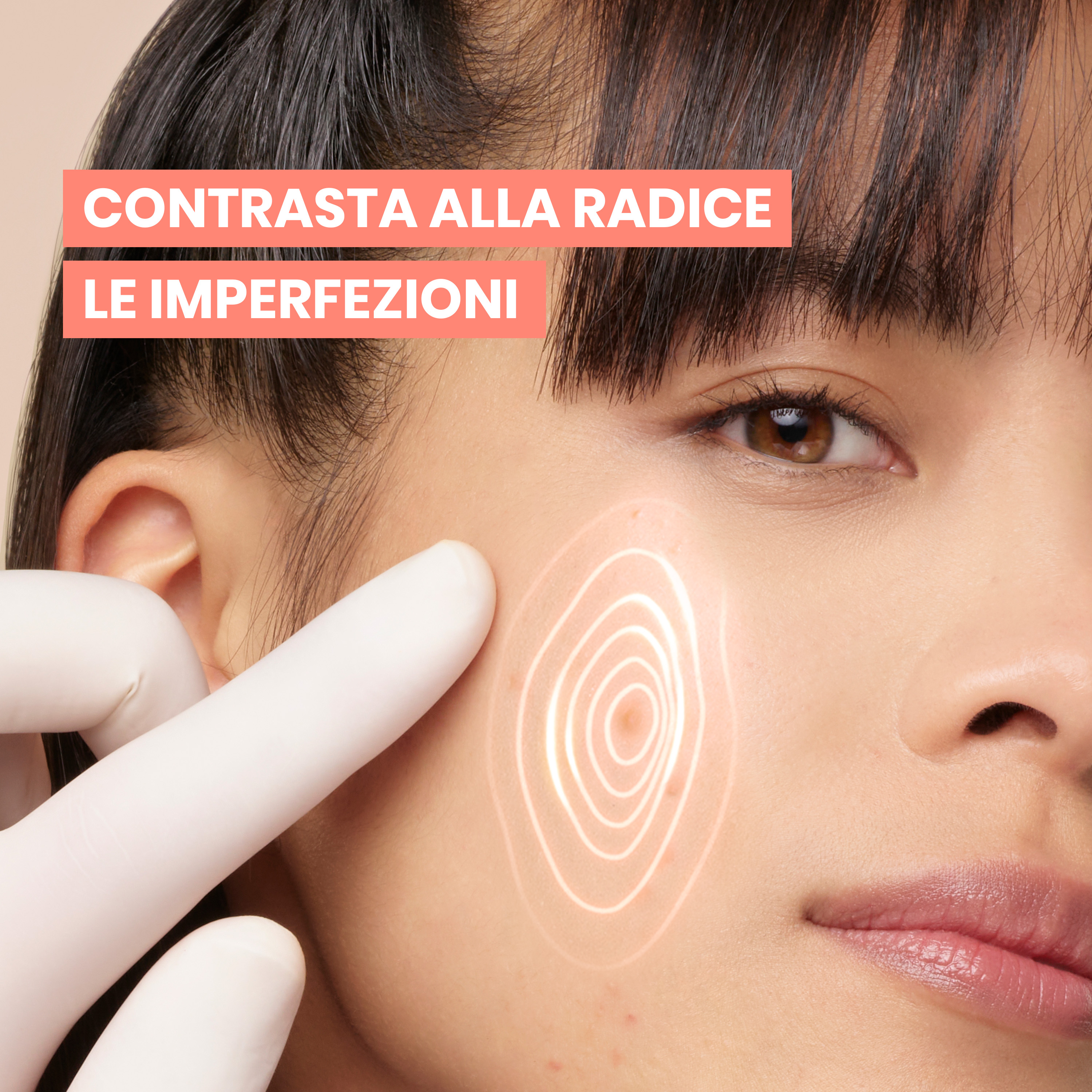 Eau Thermale Avène Cleanance Comedomed+ Trattamento Intensivo Quotidiano Anti-Imperfezioni, contrasta imperfezioni, punti neri e segni residui, Efficacia visibile in 5h, Pelle grassa a tendenza acneica, 30ml 