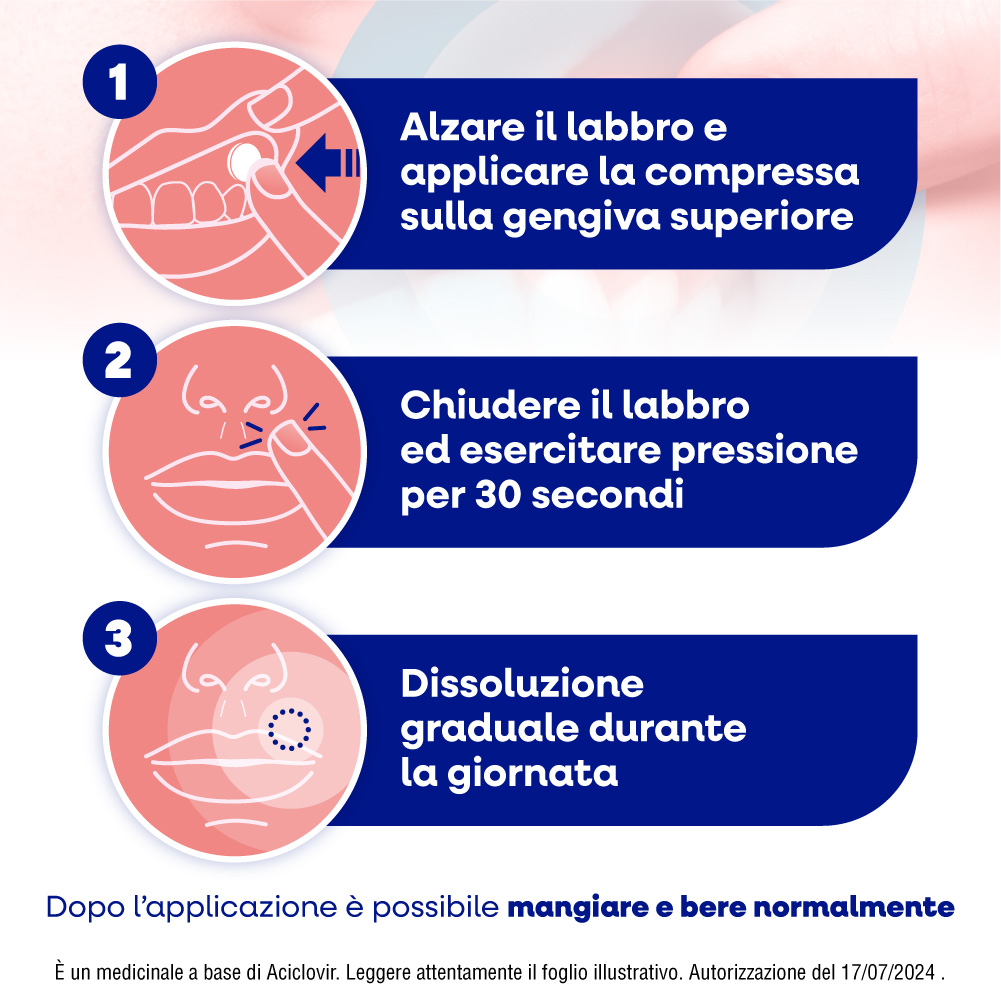 Herpmed Labiale Compresse Buccali Mucoadesive Aciclovir 50mg Herpmed Labiale Compresse Buccali Mucoadesive Aciclovir 50mg