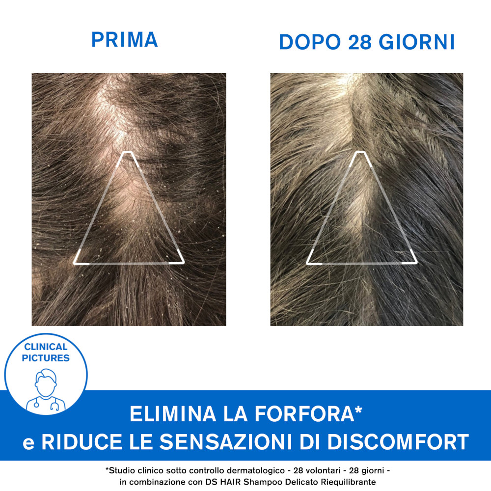 URIAGE D.S.Hair Sh.A-Forfora URIAGE D.S.Hair Sh.A-Forfora