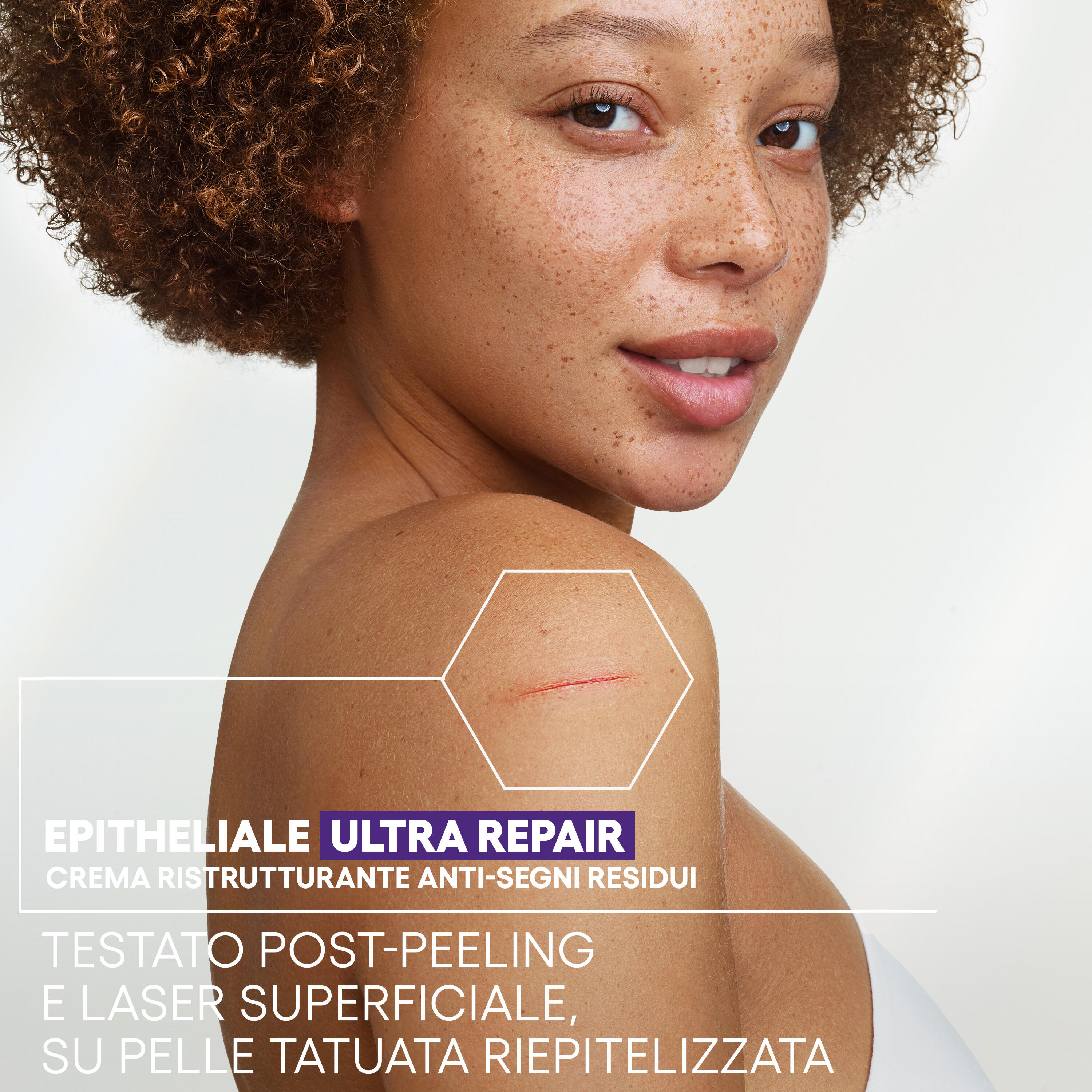 A-Derma Epitheliale Ultra Repair - Crema Ristrutturante Anti-Segni Residui 100 ml