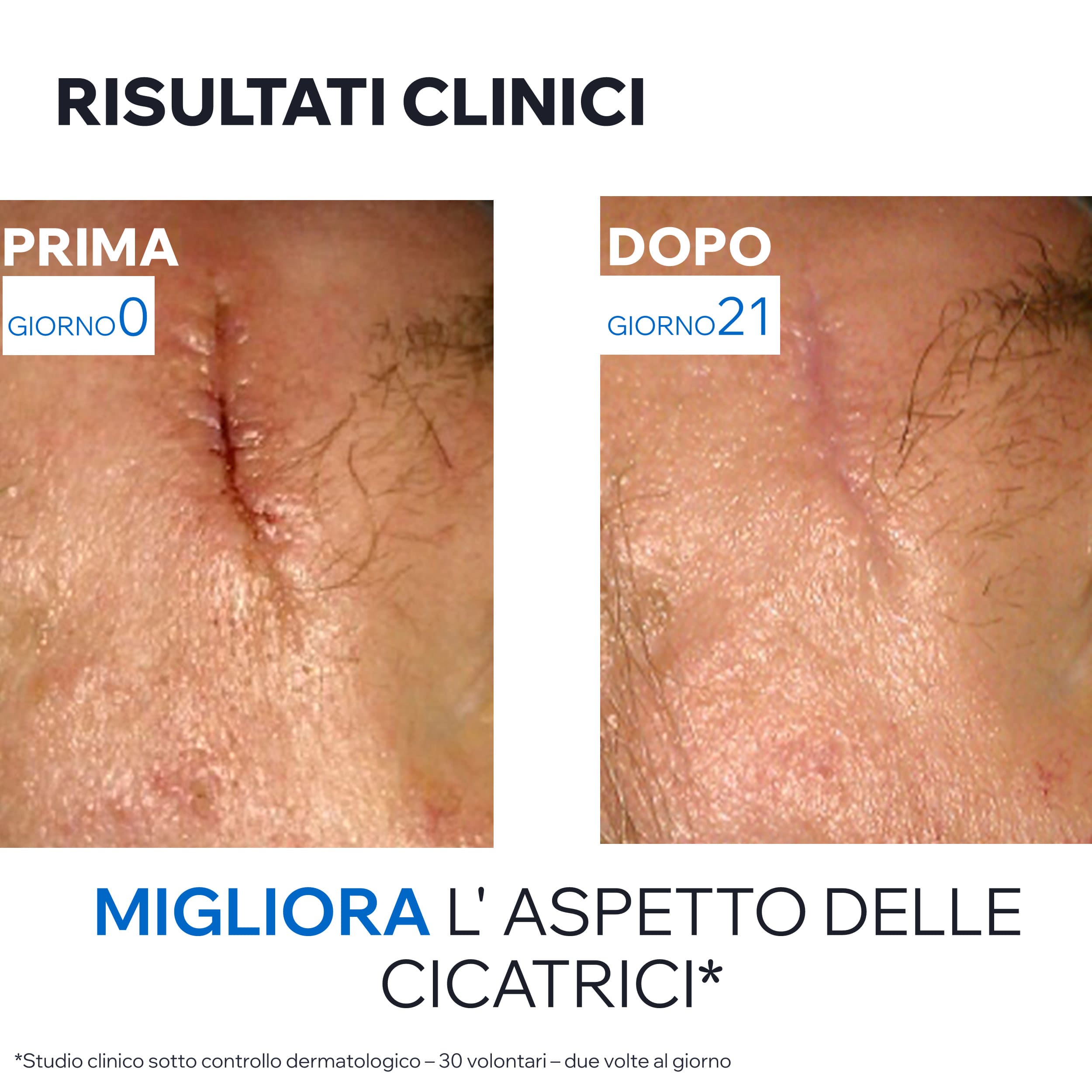 URIAGE BARIÉDERM-CICA Crema dermatologica multiuso per la riparazione della pelle alterata 40 ml
