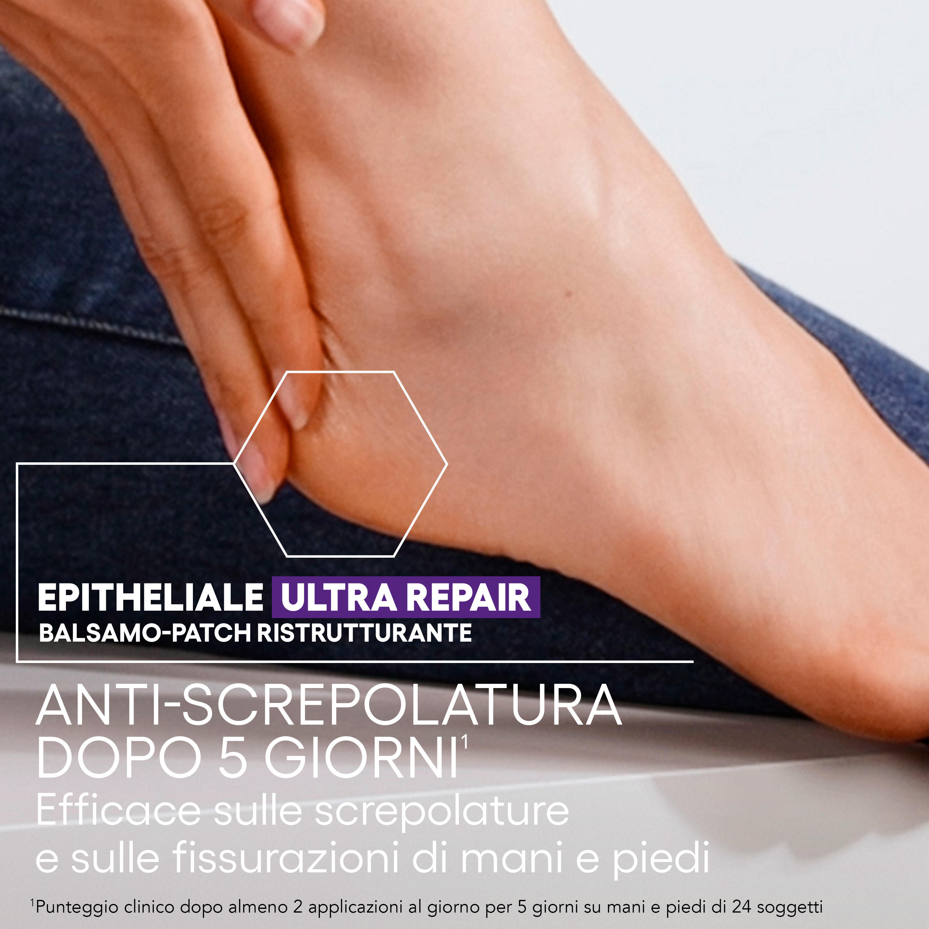 A-Derma Epitheliale Ultra Repair A.H. - Balsamo-Patch Ristrutturante Per Pelle Fragilizzata E Molto Secca 50 g