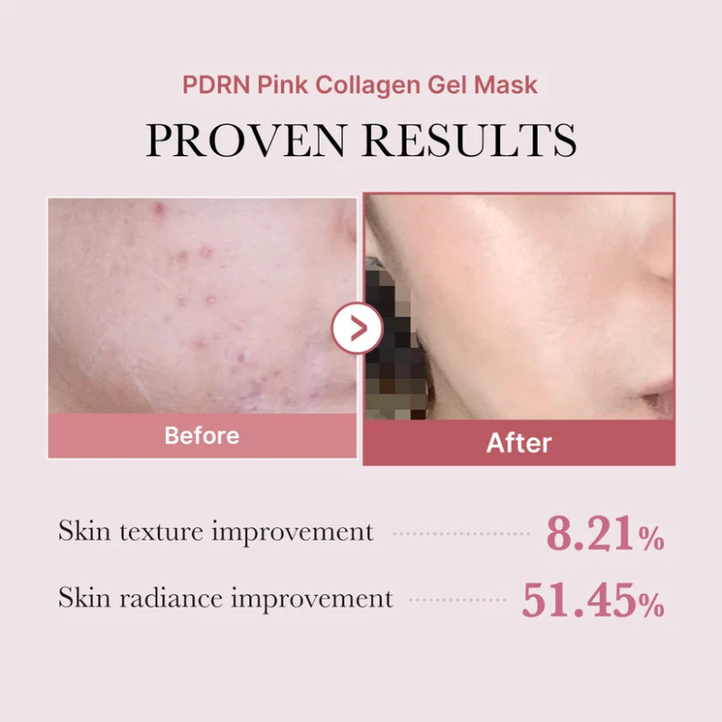 Medicube Salmon PDRN Pink Collagen Jelly Gel Mask - Maschera Illuminante Viso