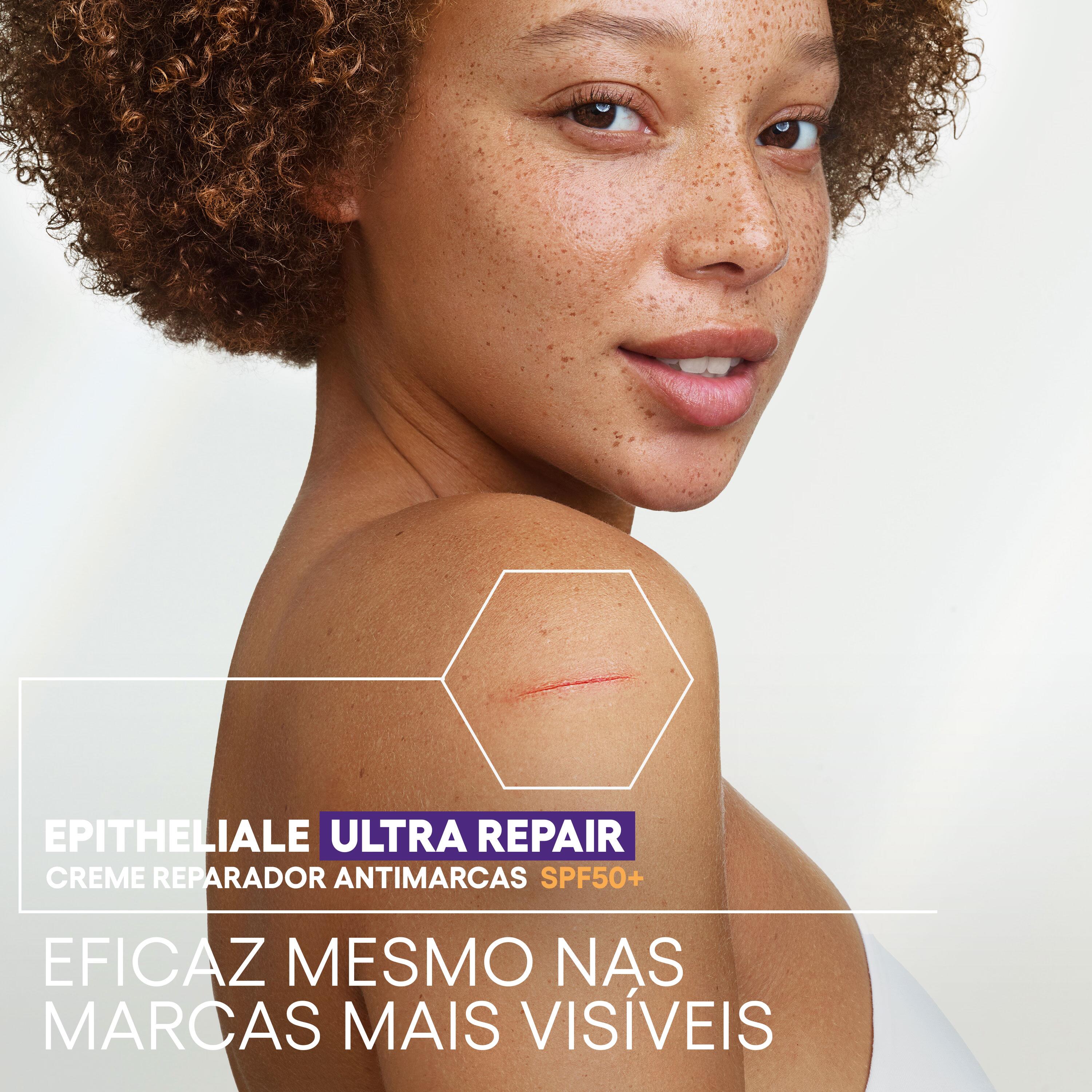 A-Derma Epitheliale Ultra Repair - Crema Ristrutturante Anti-Segni Residui SPF50+ Viso 40 ml
