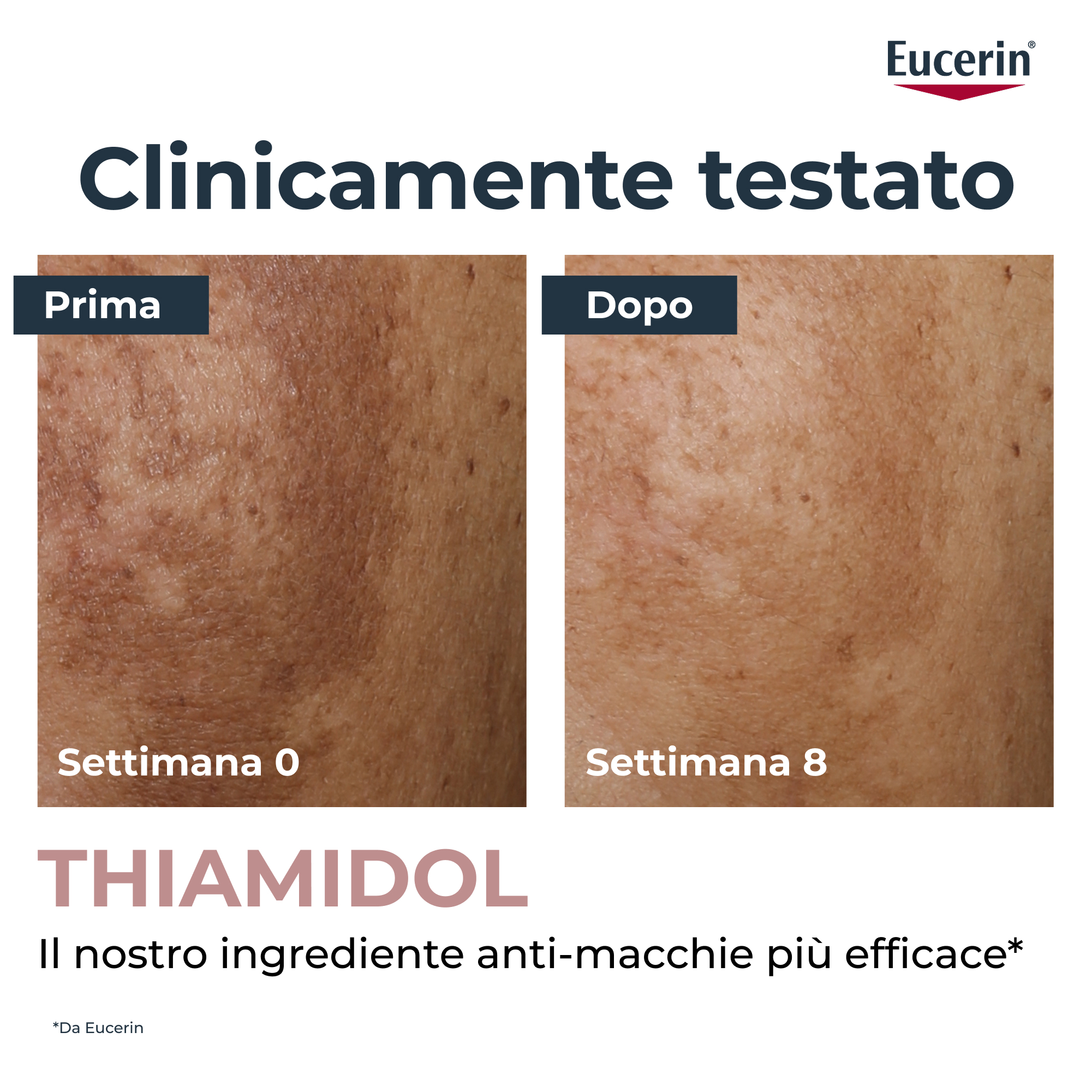 EUCERIN ANTI-PIGMENT SIERO ILL
