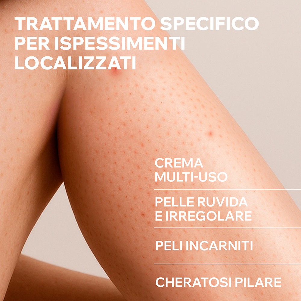 Uriage Kératosane 30 - Crema Gel Per Ispessimenti Cutanei 75 ml