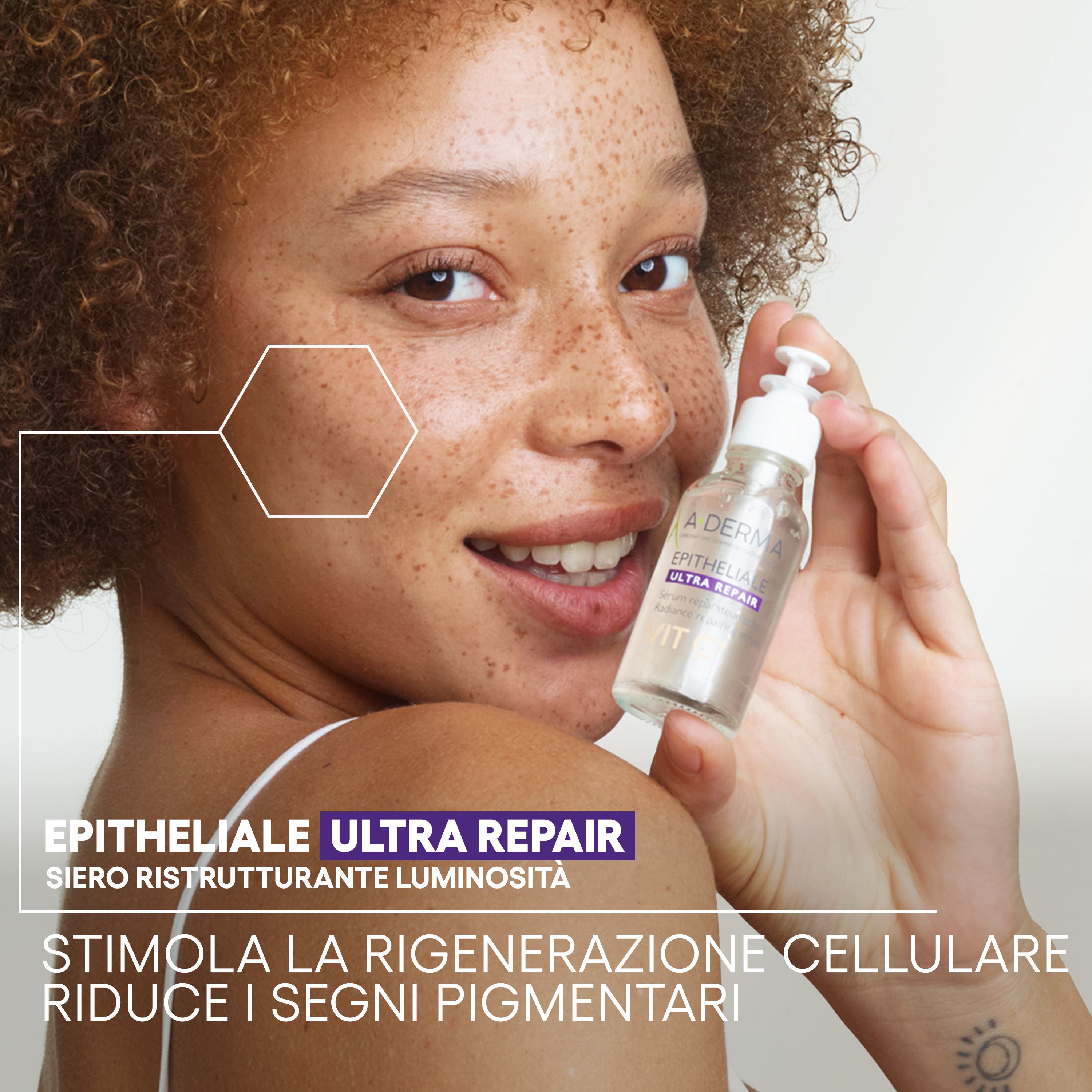 A-Derma Epitheliale Ultra Repair Siero ristrutturante luminosità, Anti-macchie, Vitamina C, 30ml 