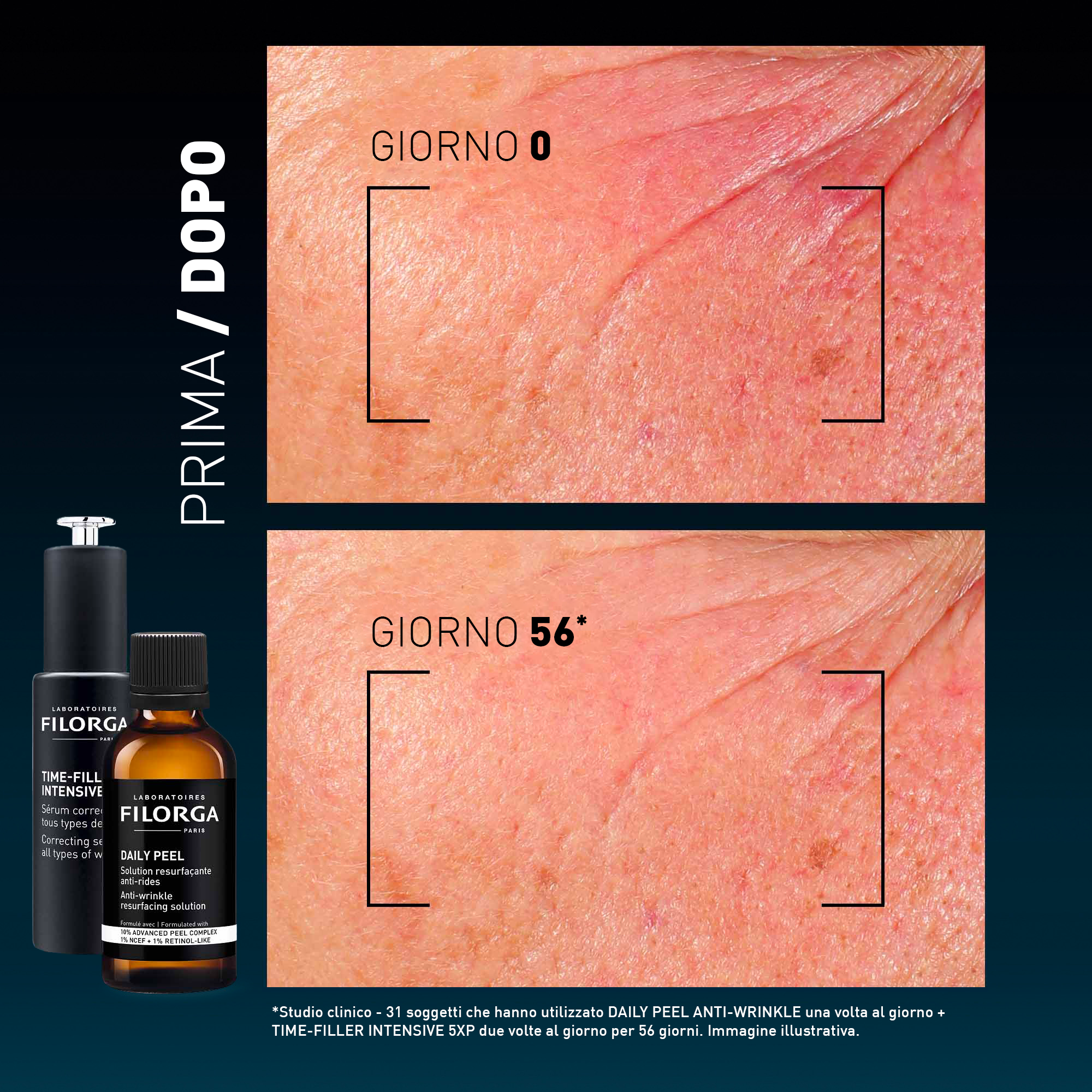 FILORGA DAILY PEEL WRINK 50ML