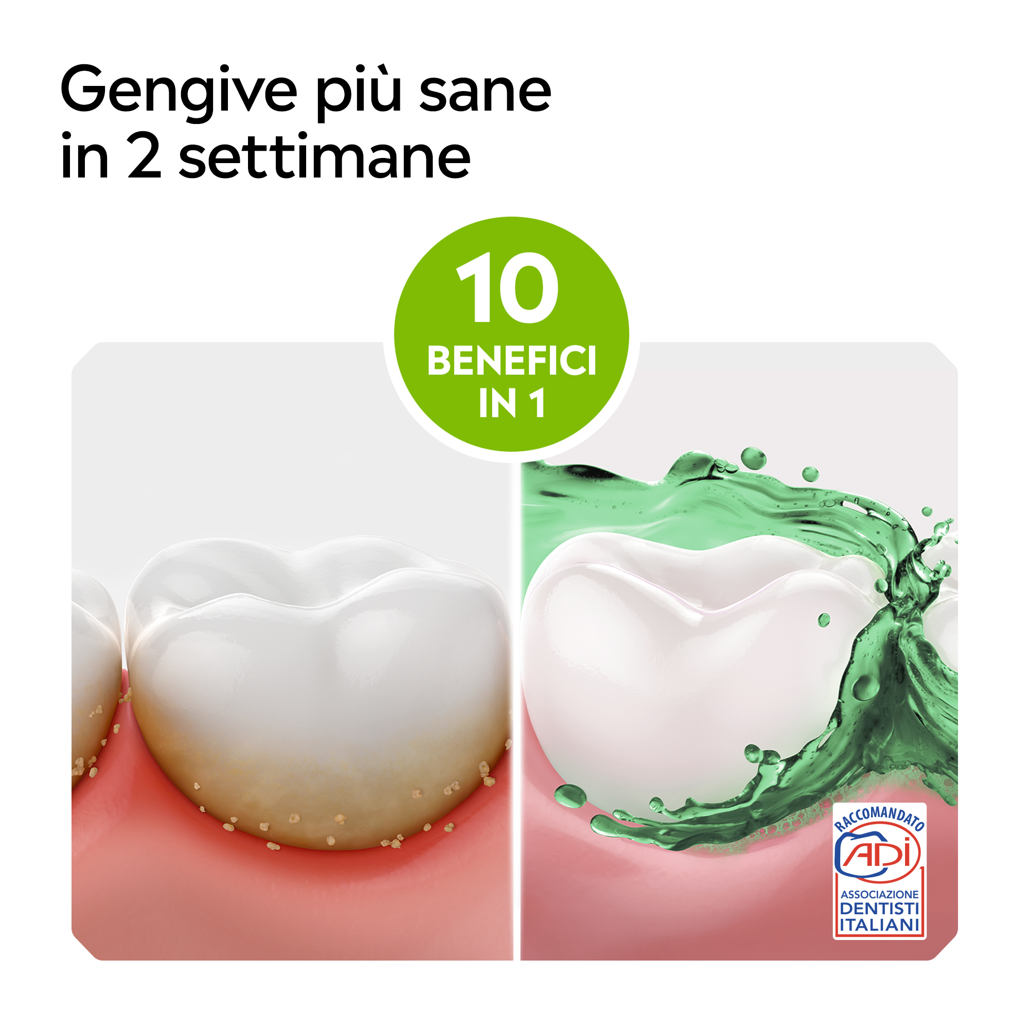 Listerine Total Care Difesa Denti E Gengive - Collutorio Senza Alcol 500 ml