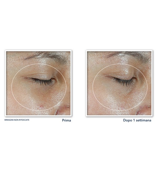 Multi Correxion Revive + Glow Eye Stick Balsamo revitalizzante per il contorno occhi 4gr Multi Correxion Revive + Glow Eye Stick Balsamo revitalizzante per il contorno occhi 4gr