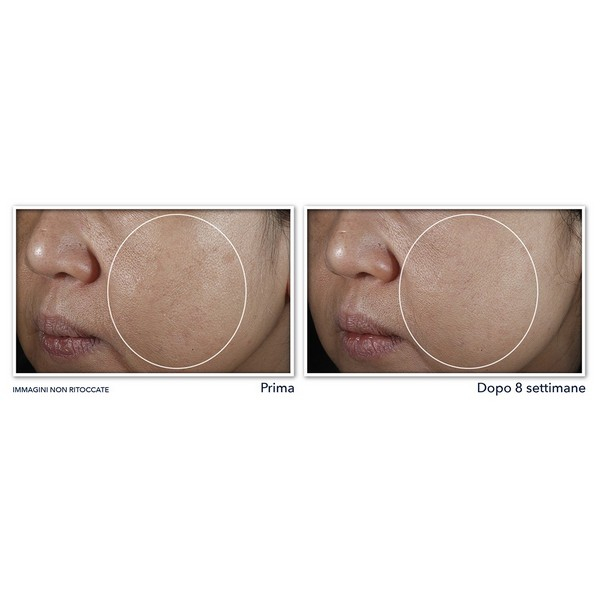 RoC Multi Correxion® Even Tone + Lift Crema Notte - 50ml