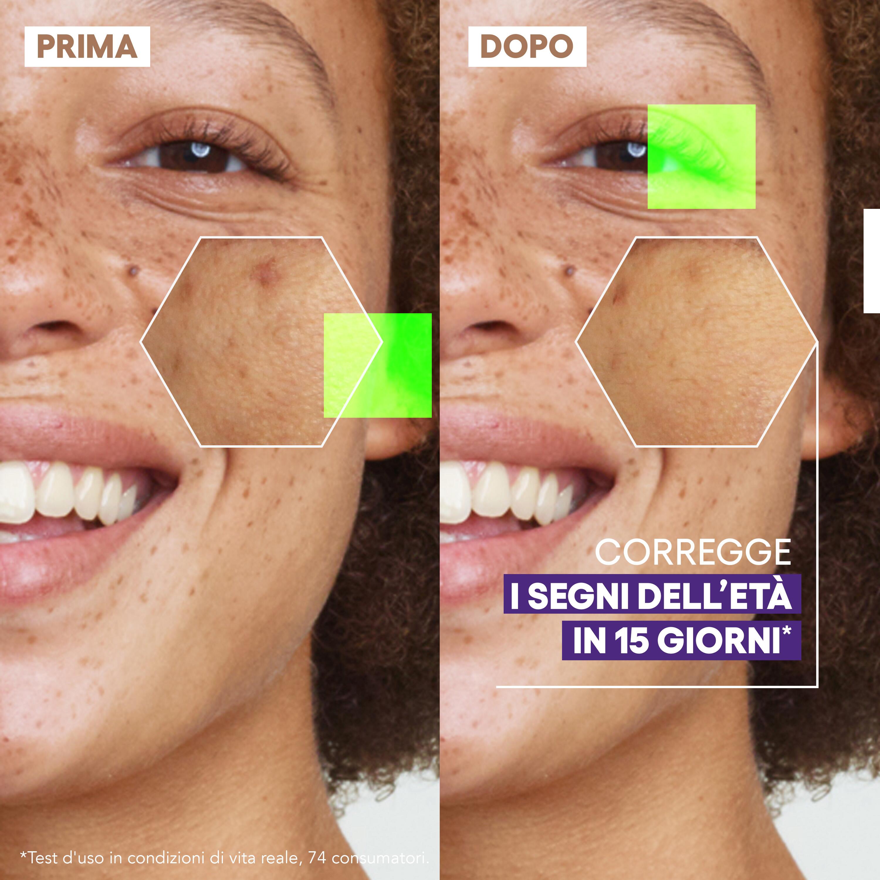 A-Derma Epitheliale Ultra Repair - Siero Ristrutturante Illuminante Anti-Macchie 30 ml 
