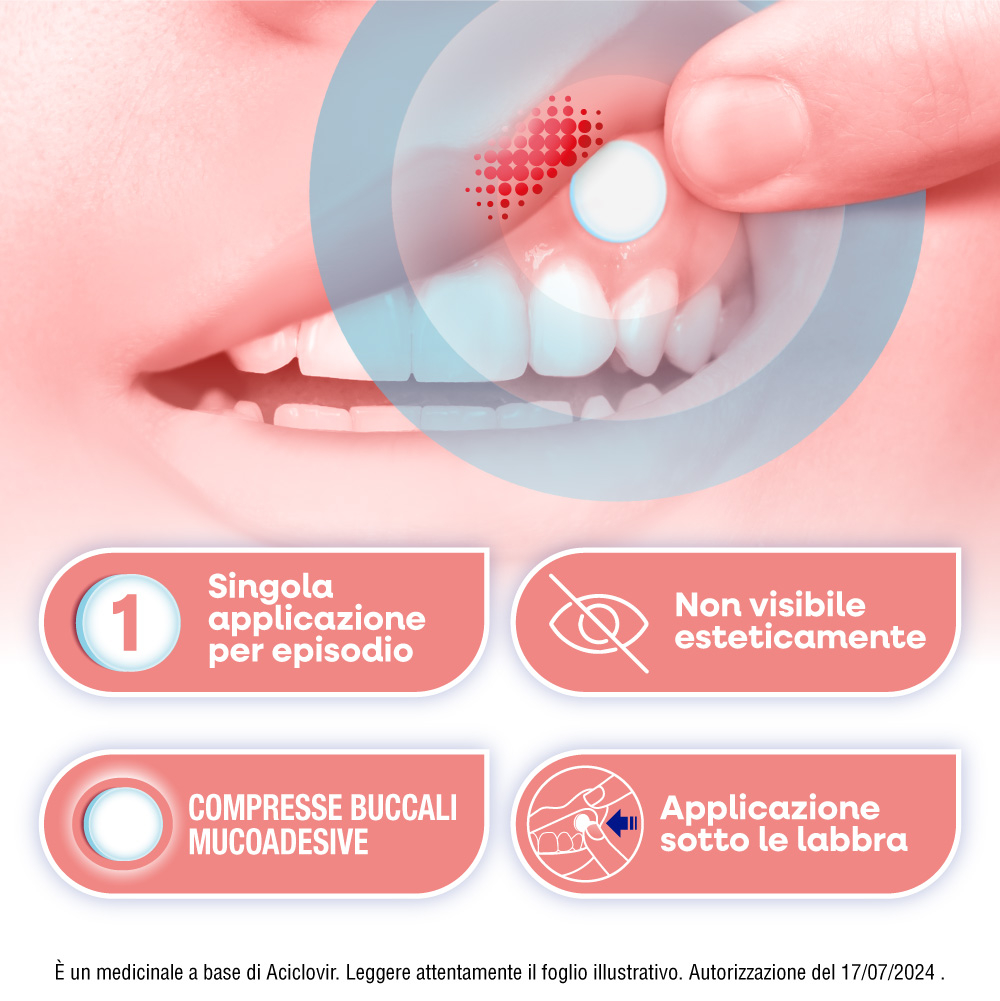Herpmed Labiale Compresse Buccali Mucoadesive Aciclovir 50mg Herpmed Labiale Compresse Buccali Mucoadesive Aciclovir 50mg